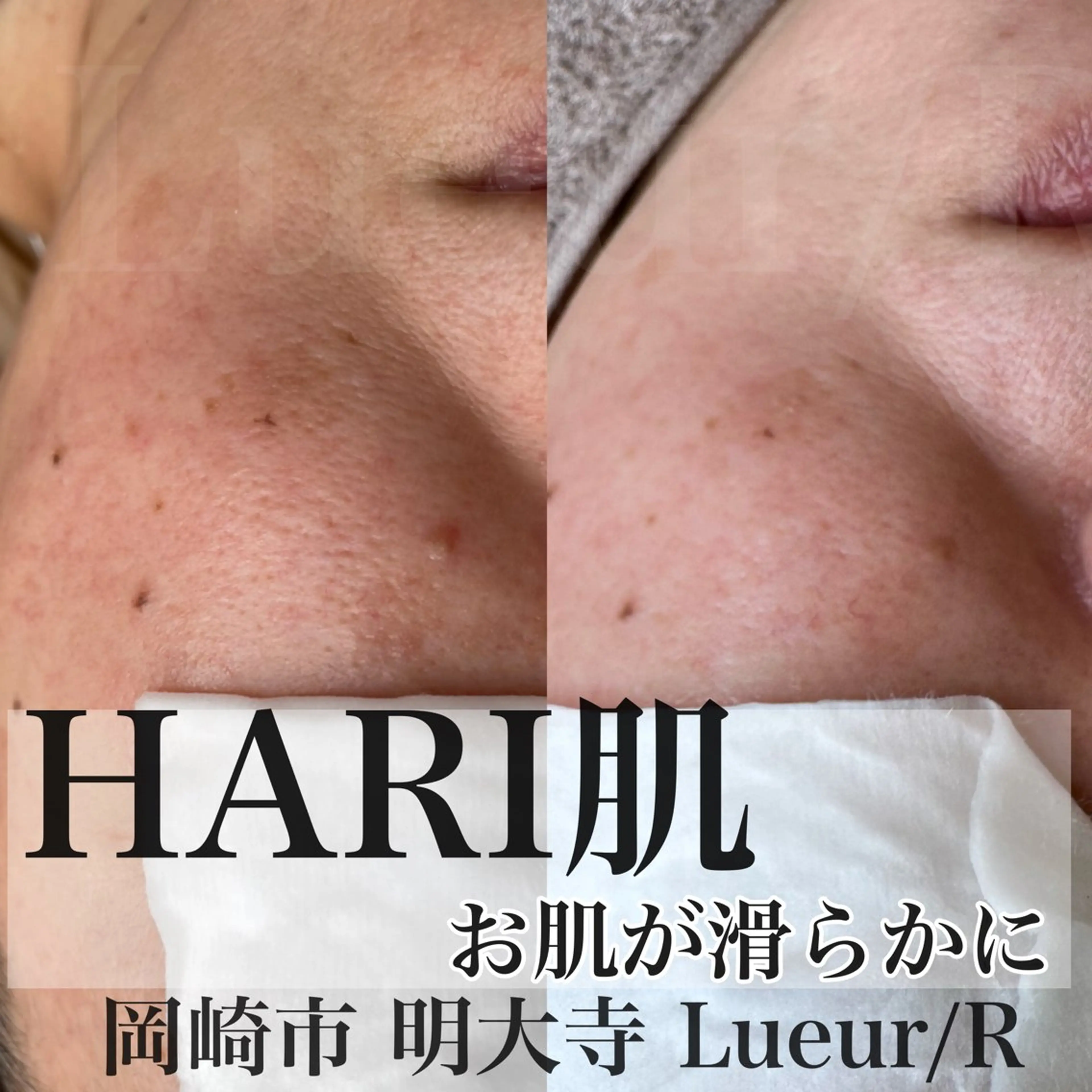 その他 大久保 里奈のエステ・リラクイメージ