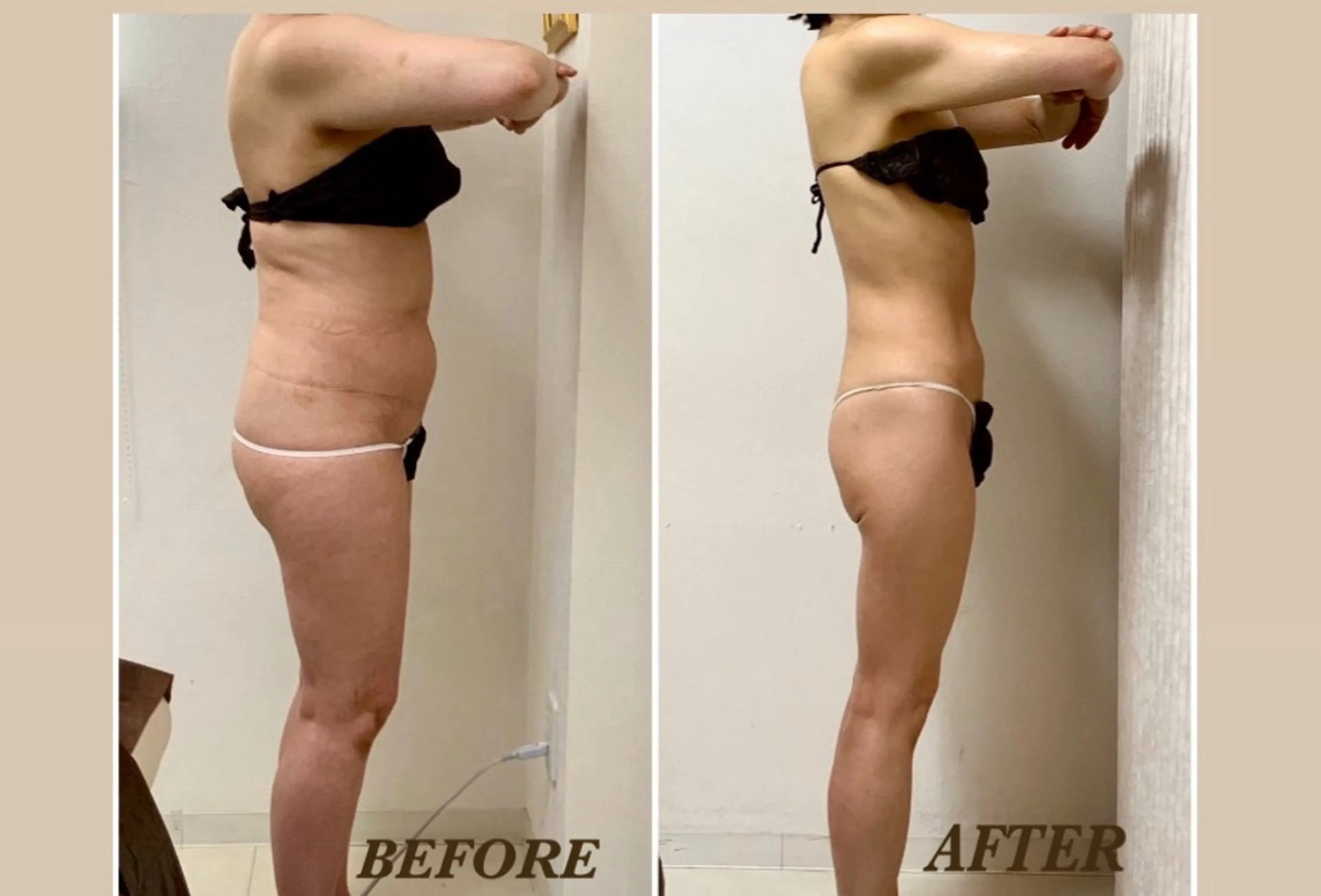 エステ リラク Prima〜プリマ〜 名古屋駅店所属・Prima 痩身脱毛 にごうかおりのエステ・リラクイメージ