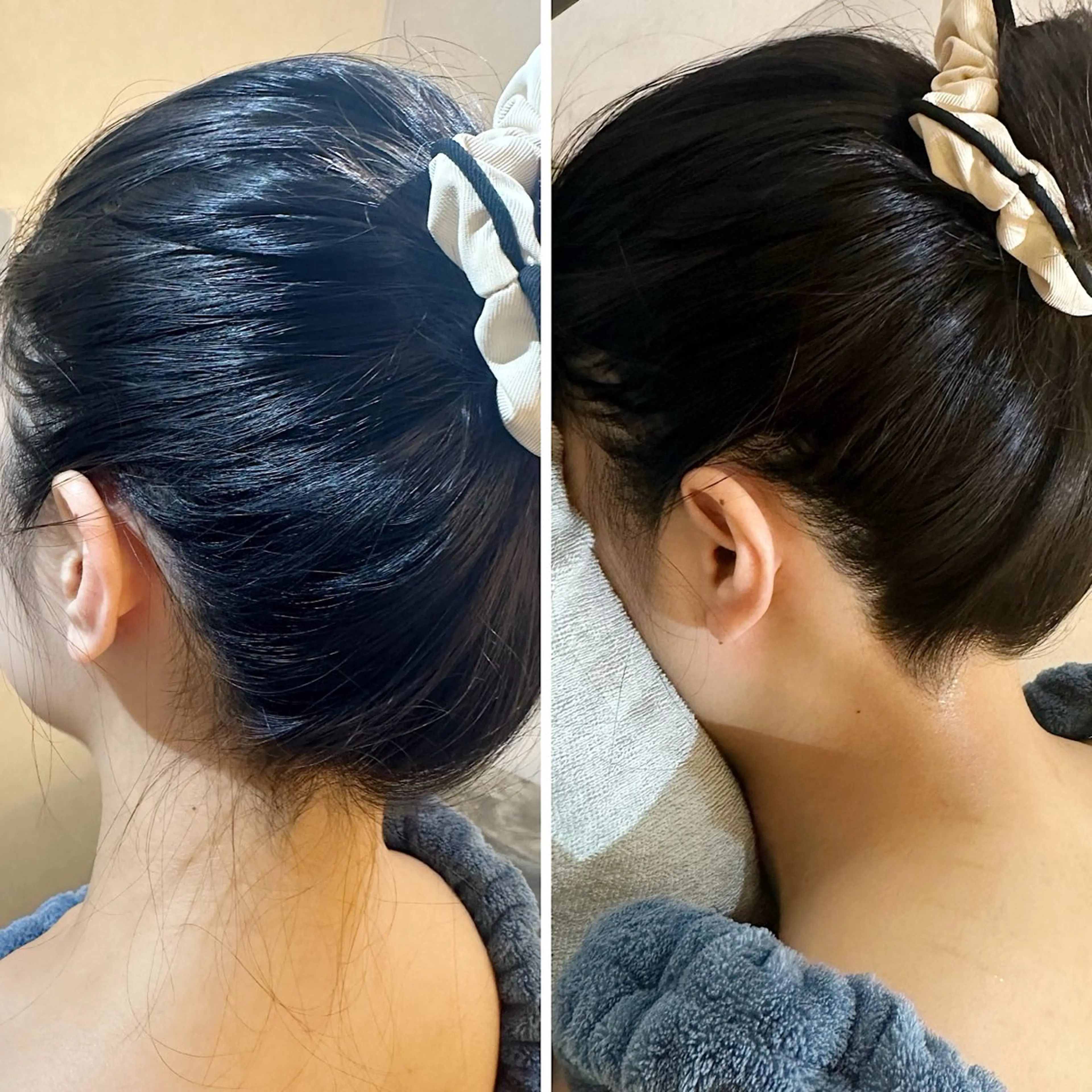 脱毛 うなじ脱毛/美肌脱毛 LABELのエステ・リラクイメージ