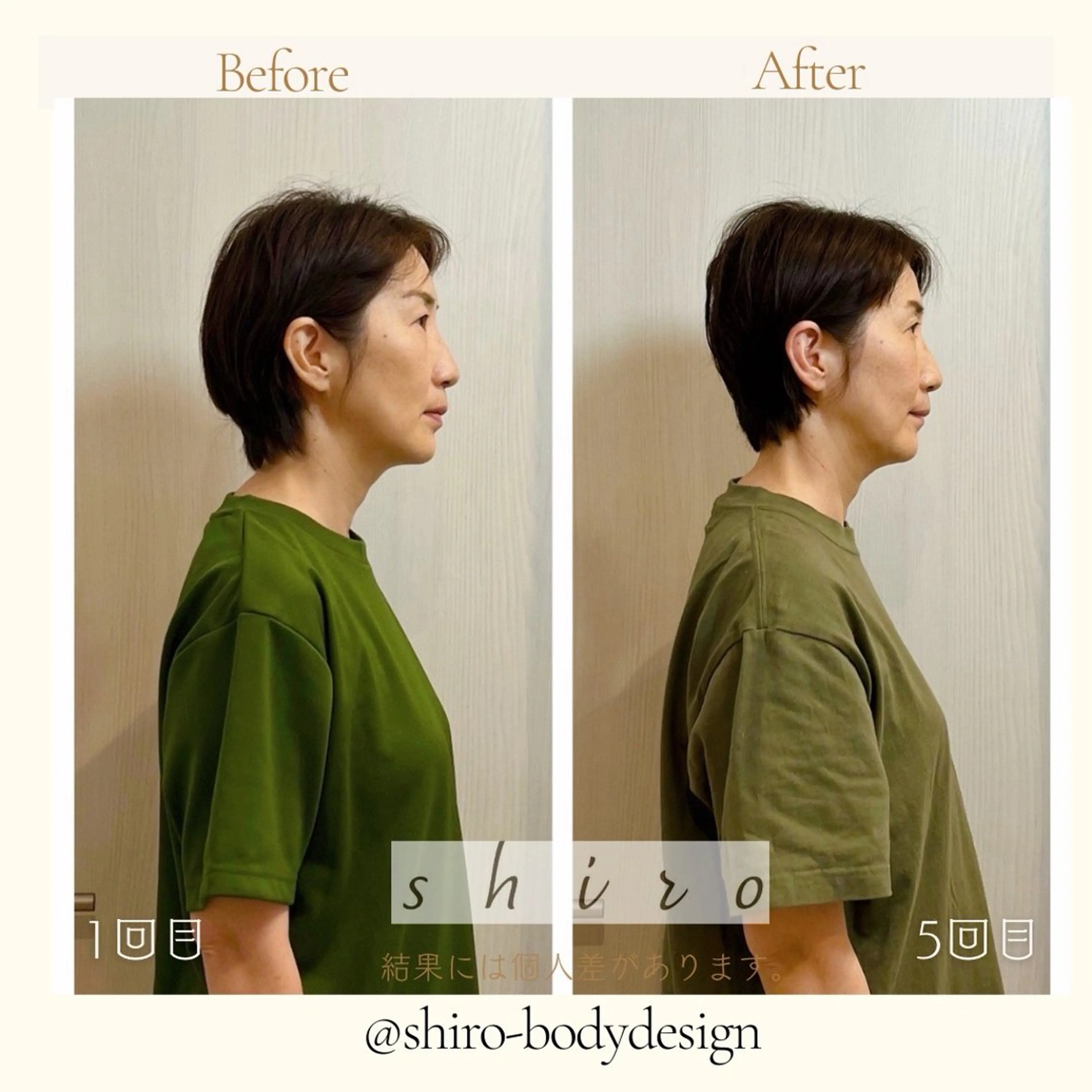 小顔美容矯正勝山式 shiroしろのエステ・リラクイメージ