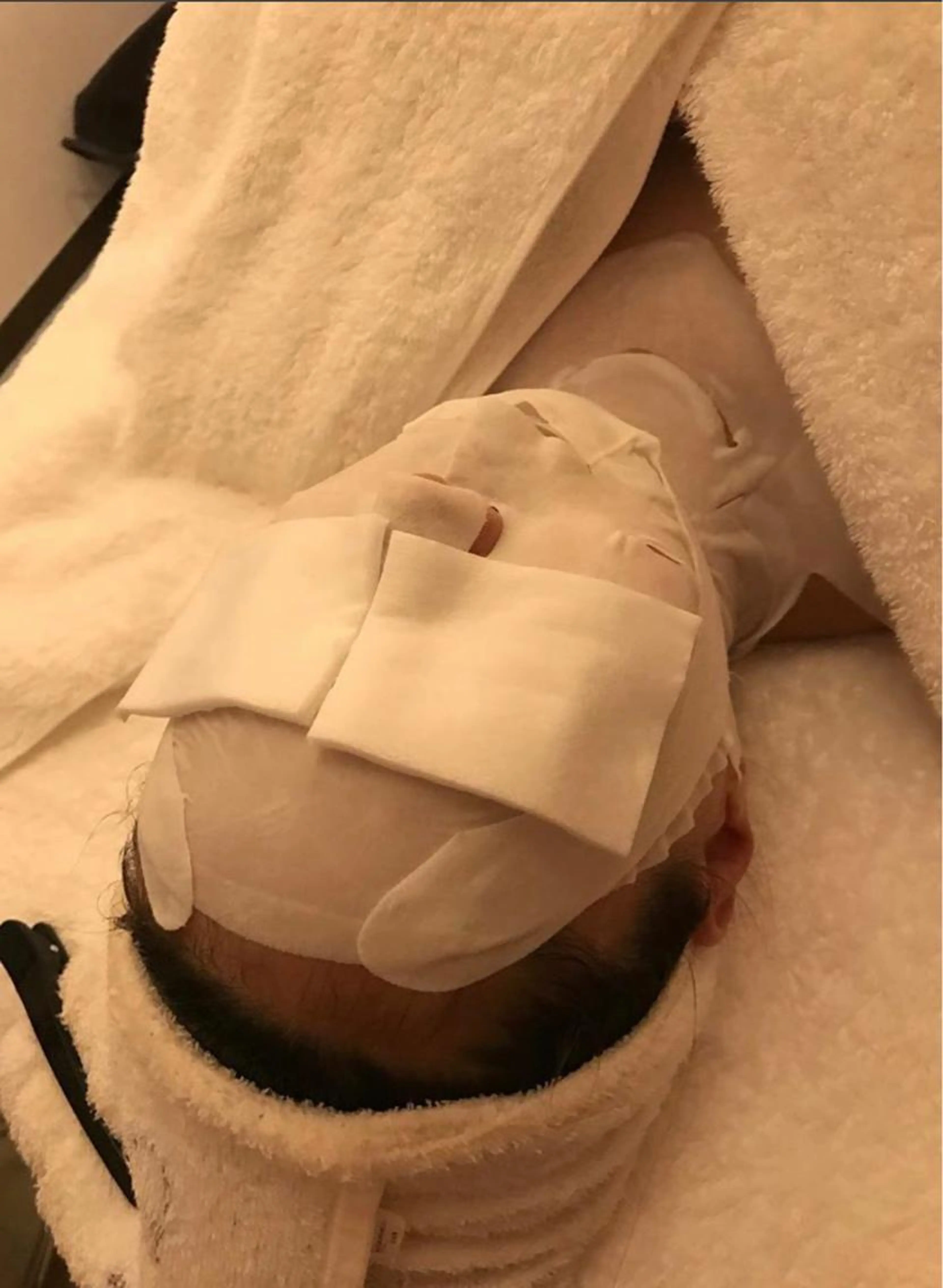 切らない美容整形💎オーセントマスク付き✨アドバンスコース(イルネージュ使用)の写真