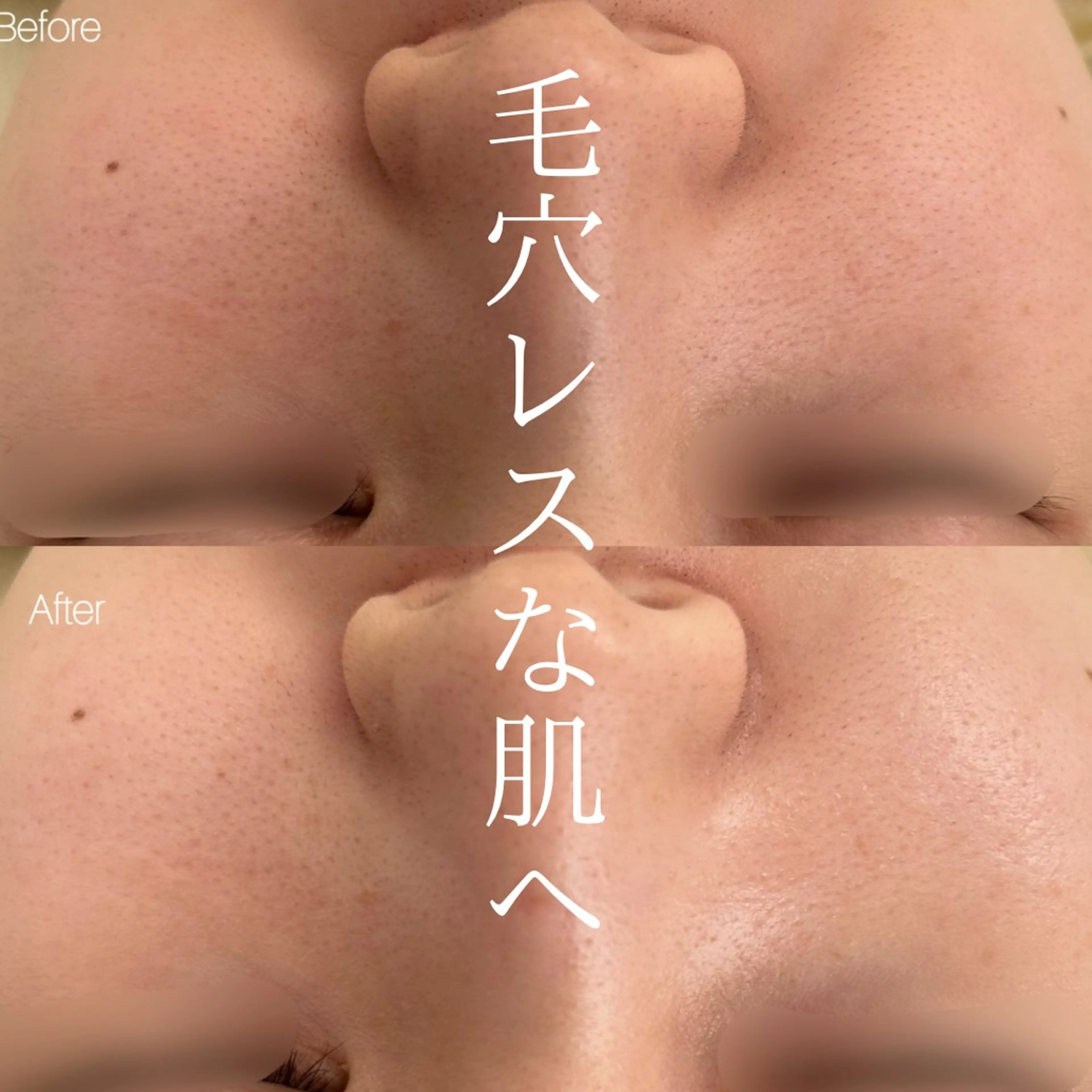 エステ 〈etre〉トータルビューティーサロン所属・etre - 韓国肌管理 -のエステ・リラクイメージ