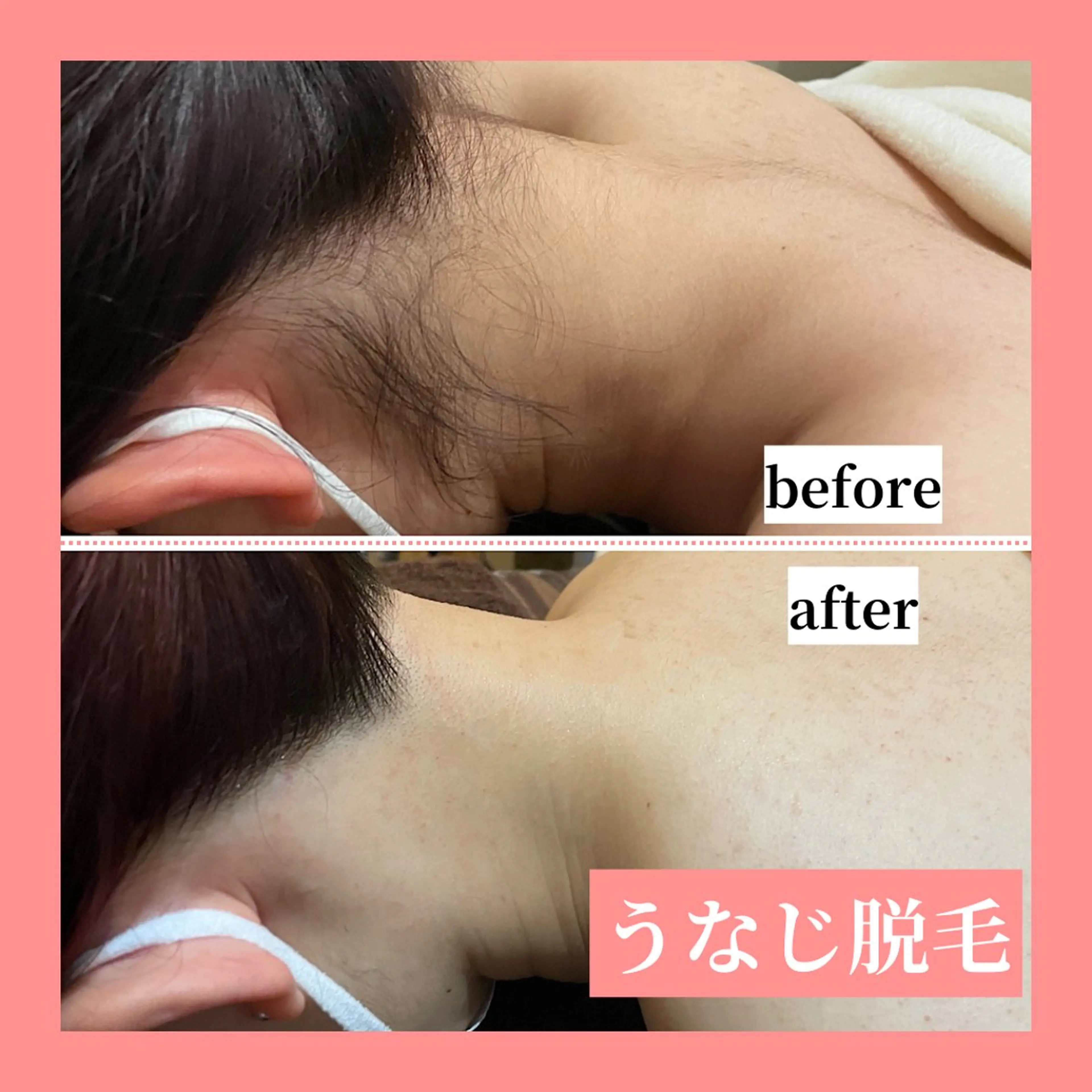 メンズ 天神【効果重視脱毛】 YouMakeのエステ・リラクイメージ