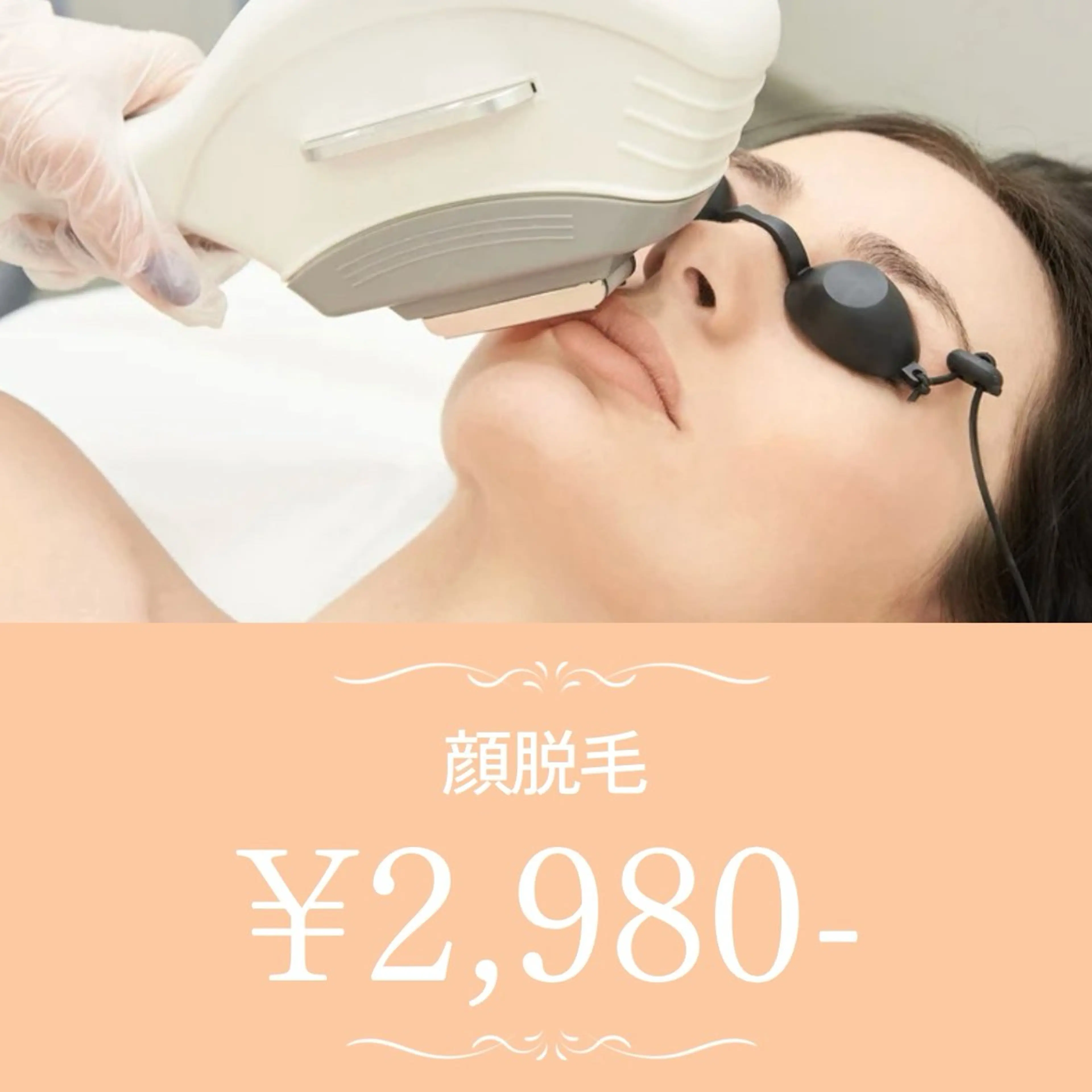 【当店人気No.3】化粧ノリ◎美白◎ムダ毛排除で美白肌♪顔脱毛　¥2,980-の写真