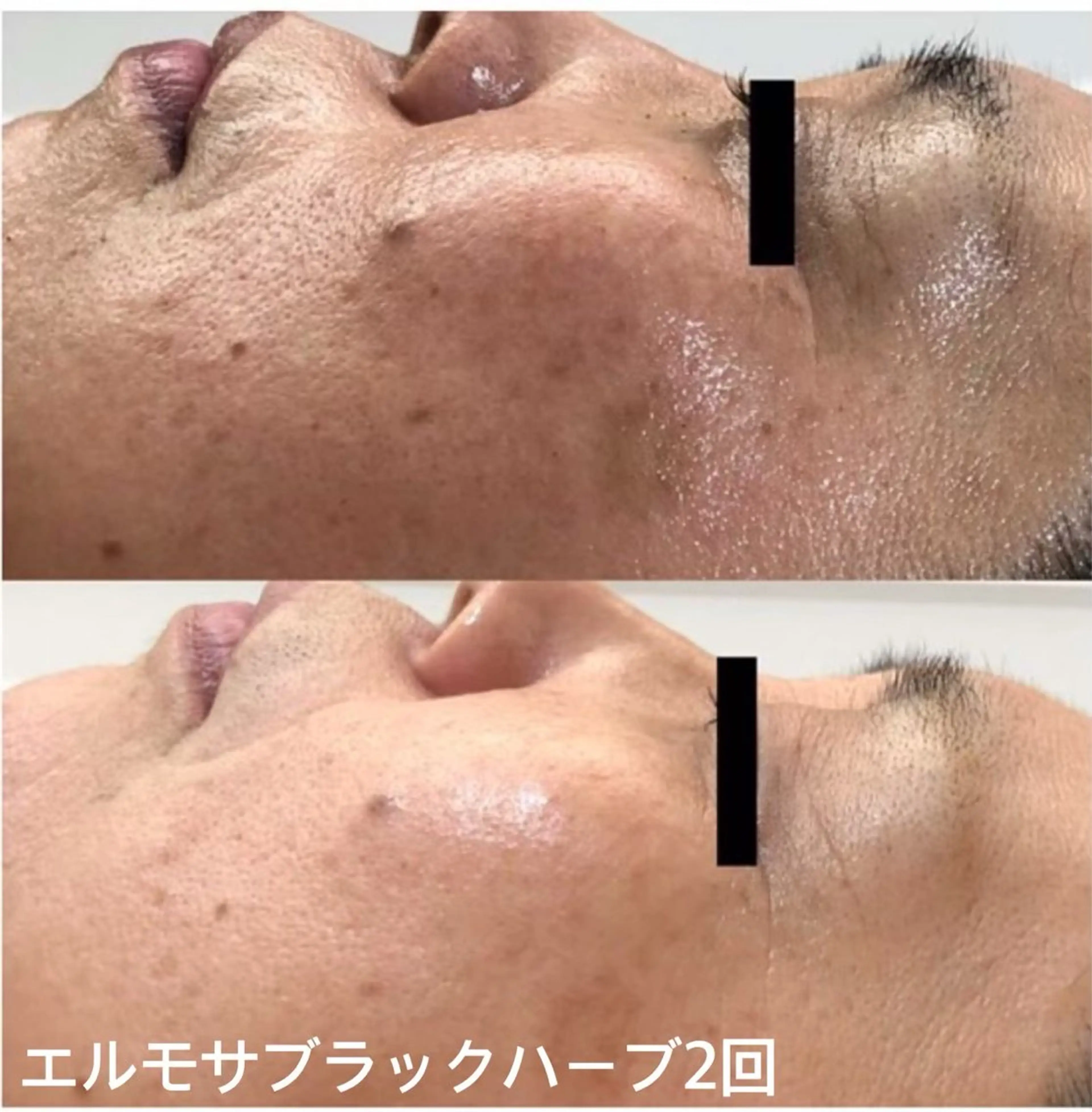 オールハンド フェイシャルのエステ・リラクイメージ