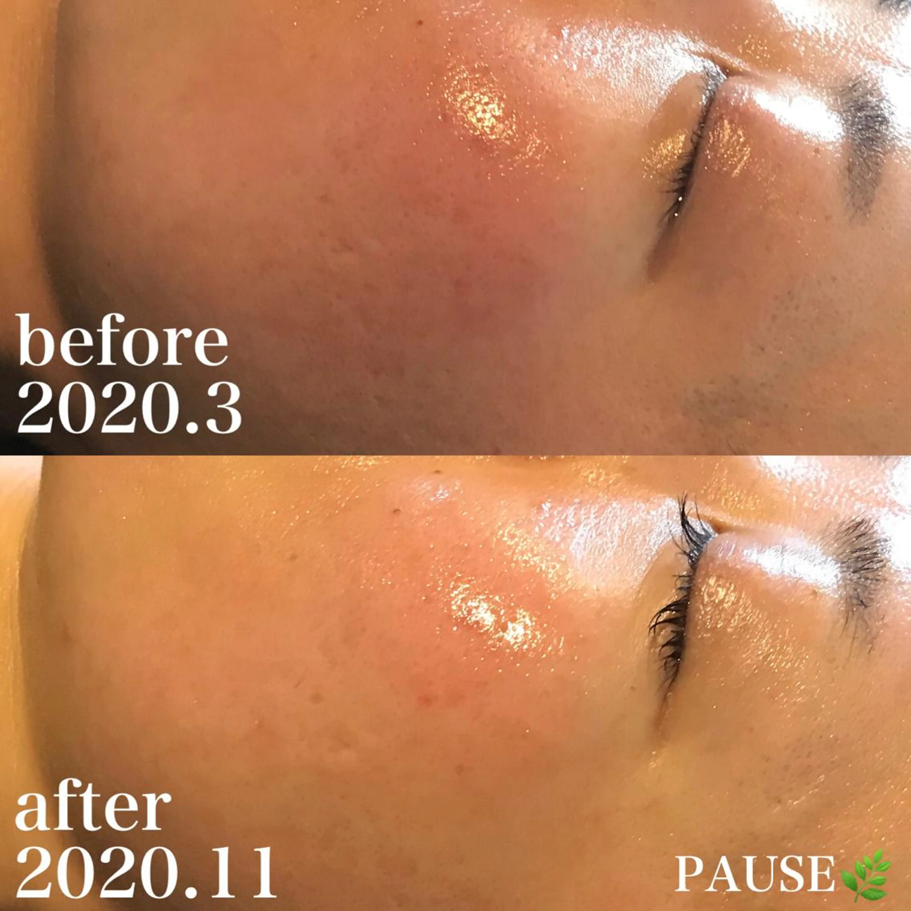 エステ 浜野 恵美のエステ・リラクイメージ