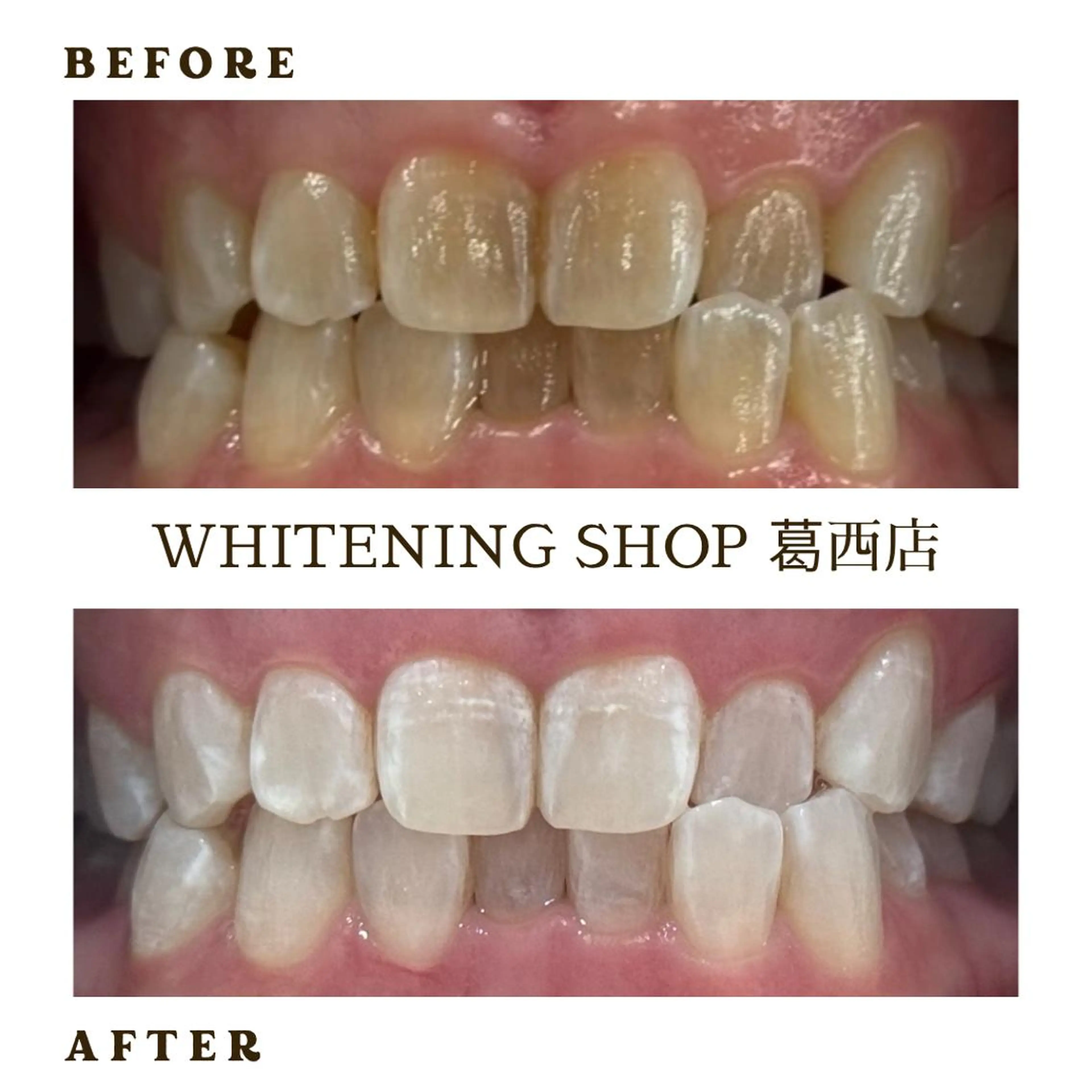 メンズ その他 ホワイトニング ショップ葛西店のその他イメージ