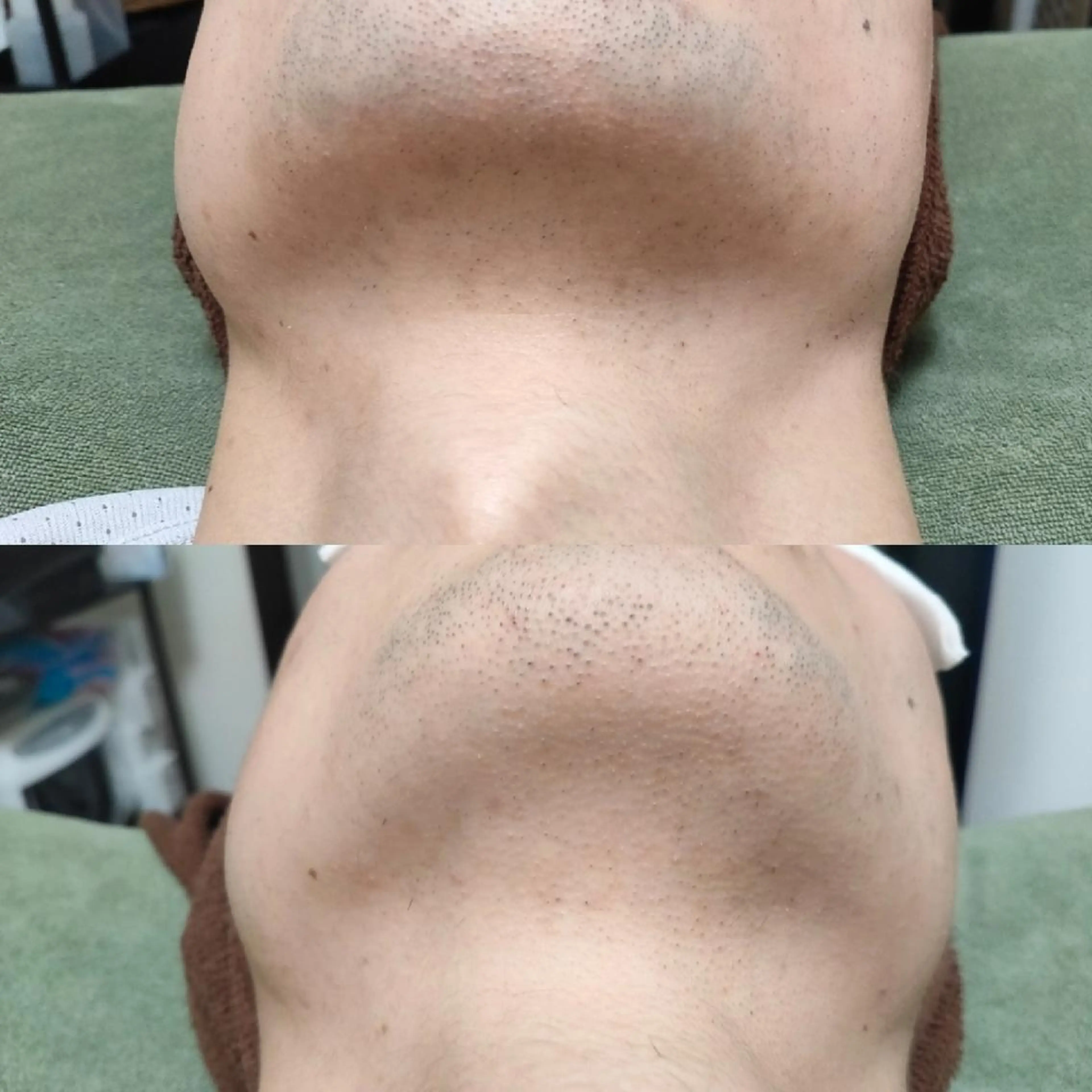 メンズ 武 藤のエステ・リラクイメージ