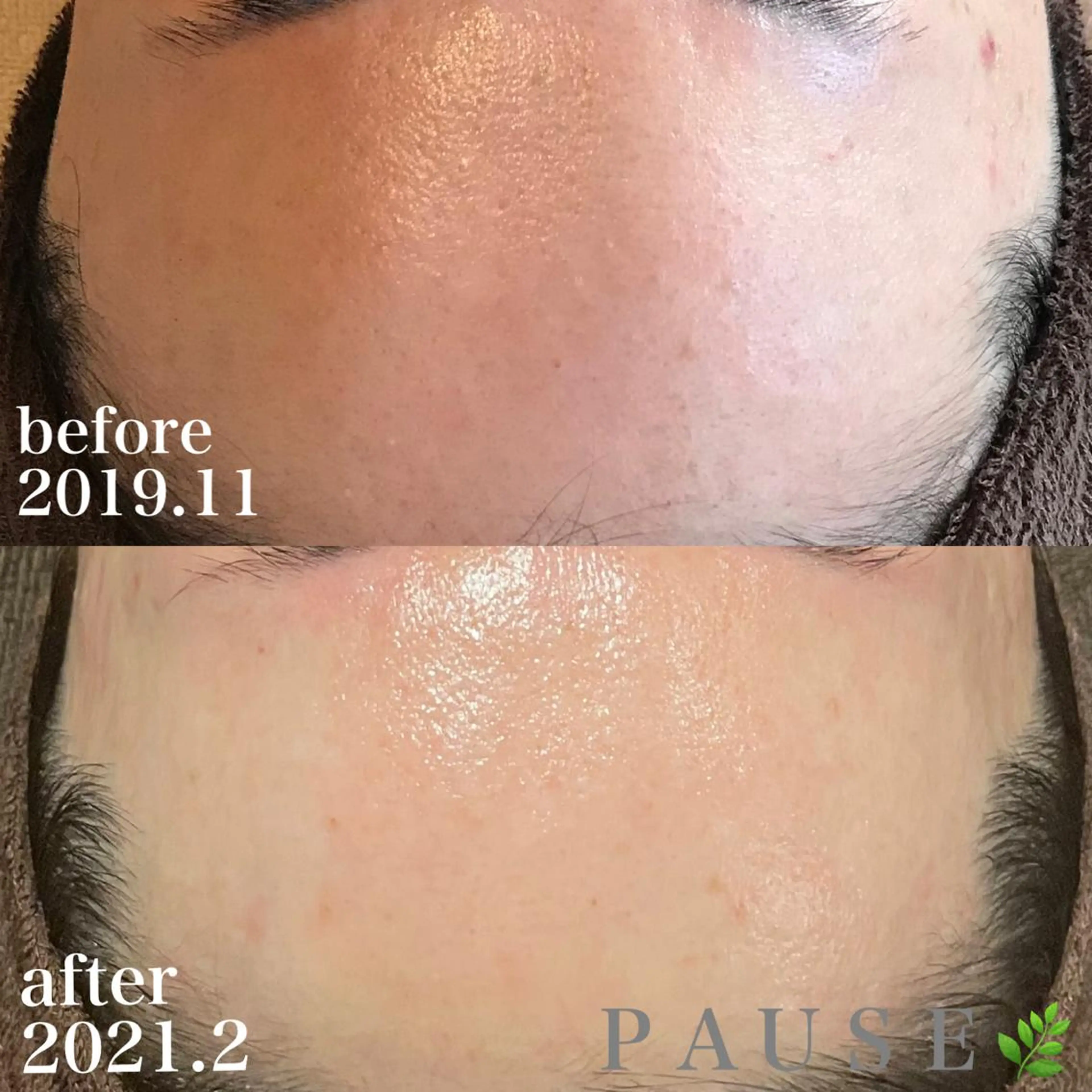 エステ 浜野 恵美のエステ・リラクイメージ