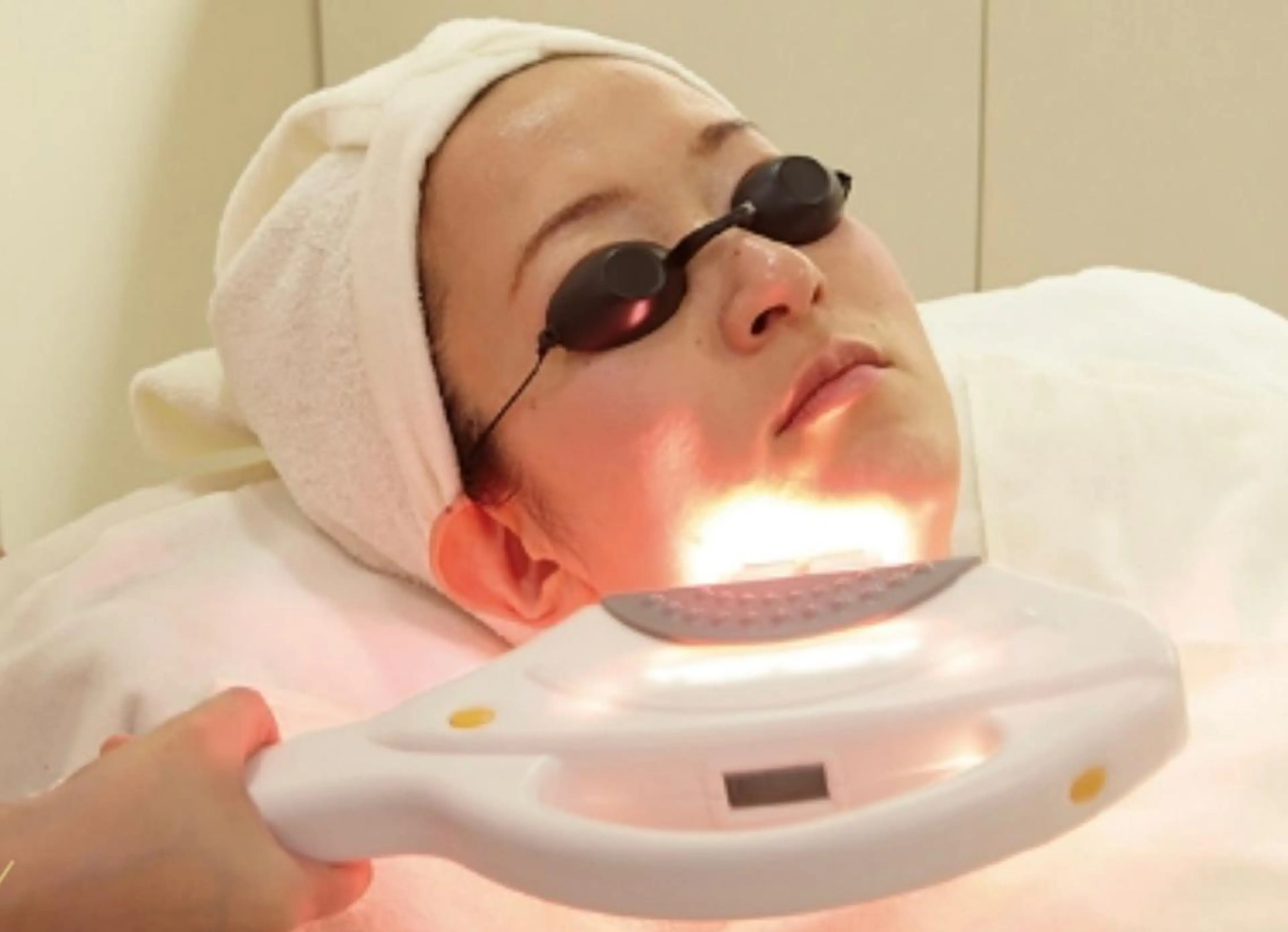 🍥2番人気🍥【レディース脱毛🎀】VIO光脱毛¥8,800→¥4,980の写真