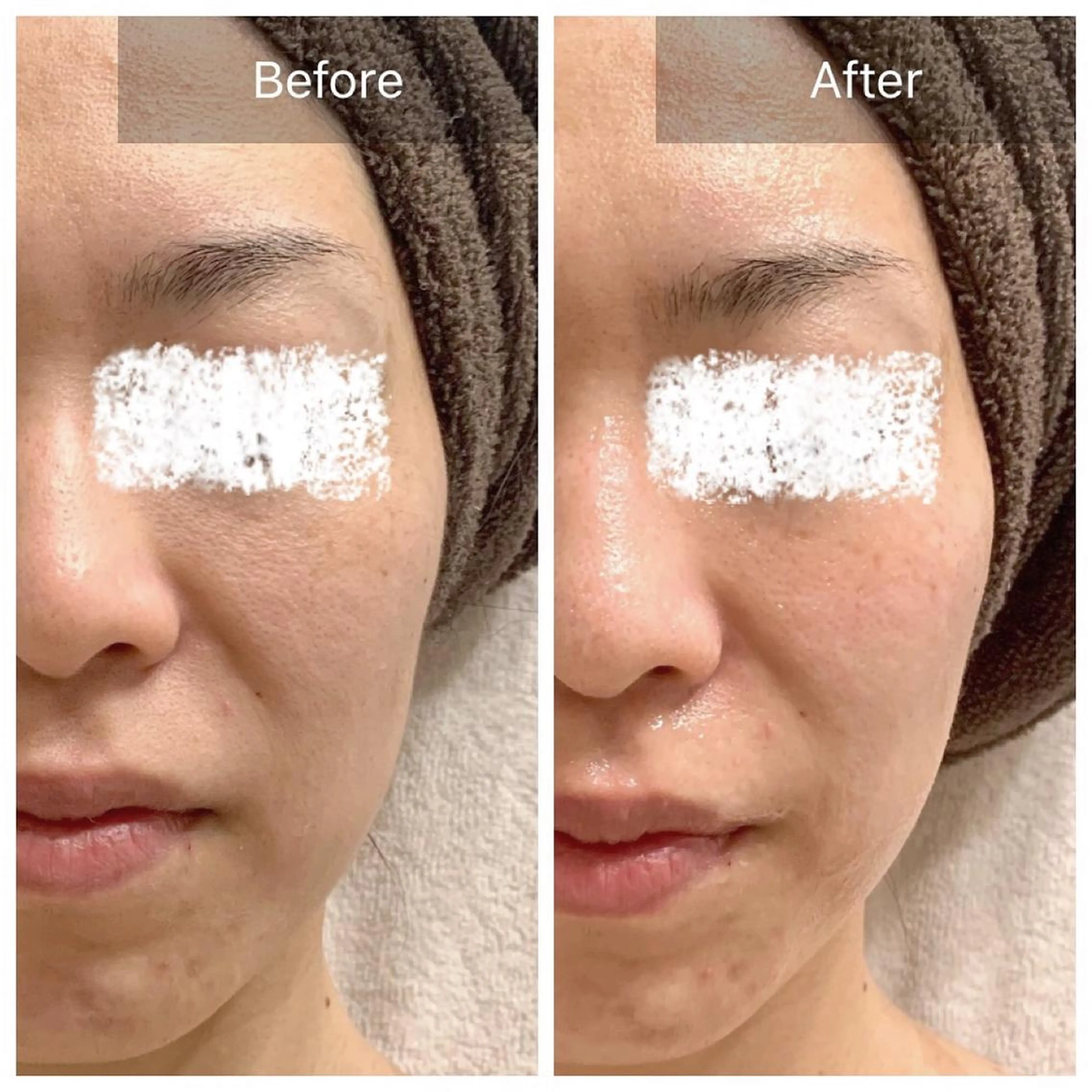 エステ Charis エステ&ネイルのエステ・リラクイメージ