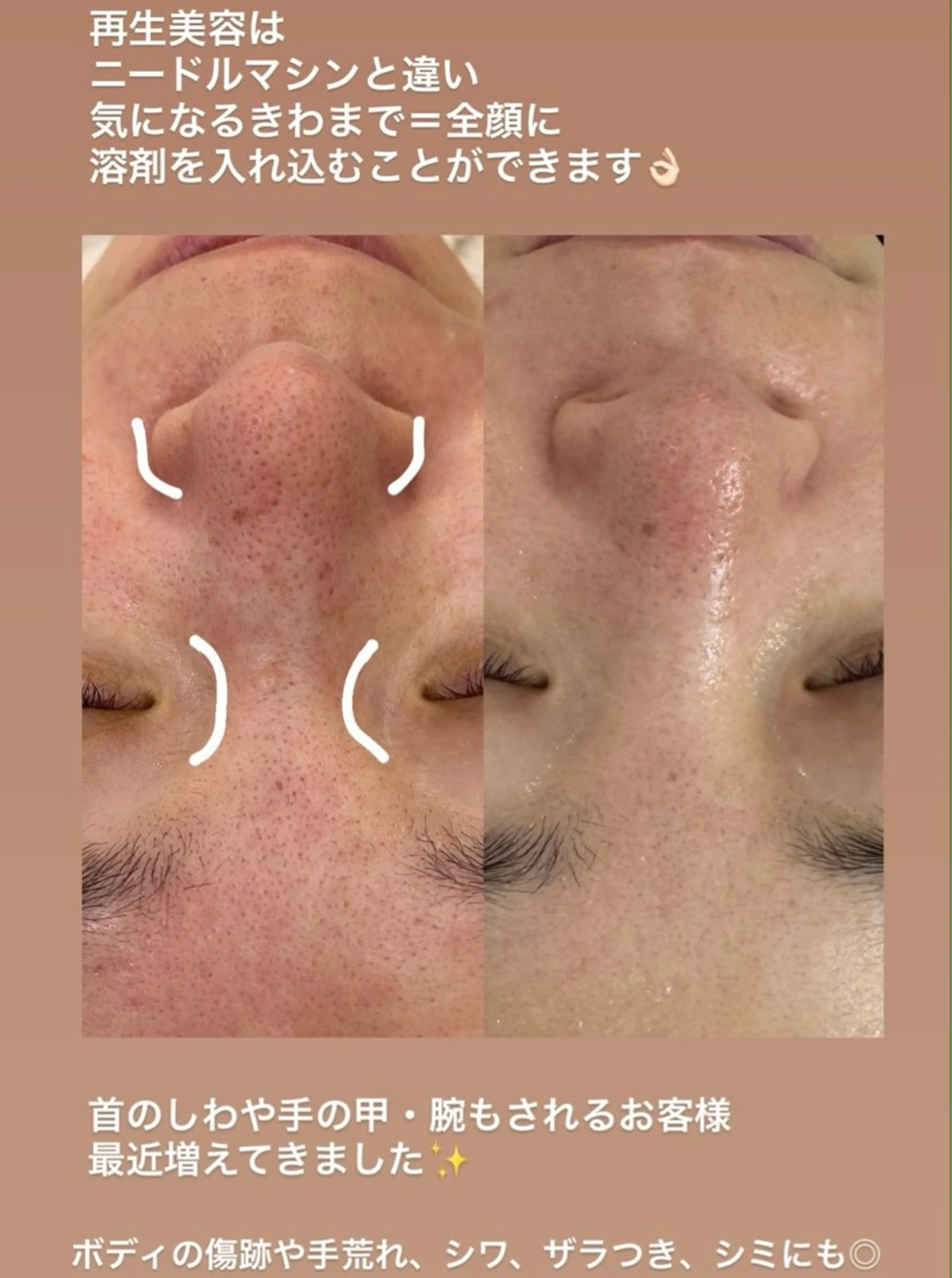 【福岡市西区 エステ】 GRANVIR(グランヴィール)所属・GRANVIR グランヴィールのエステ・リラクイメージ