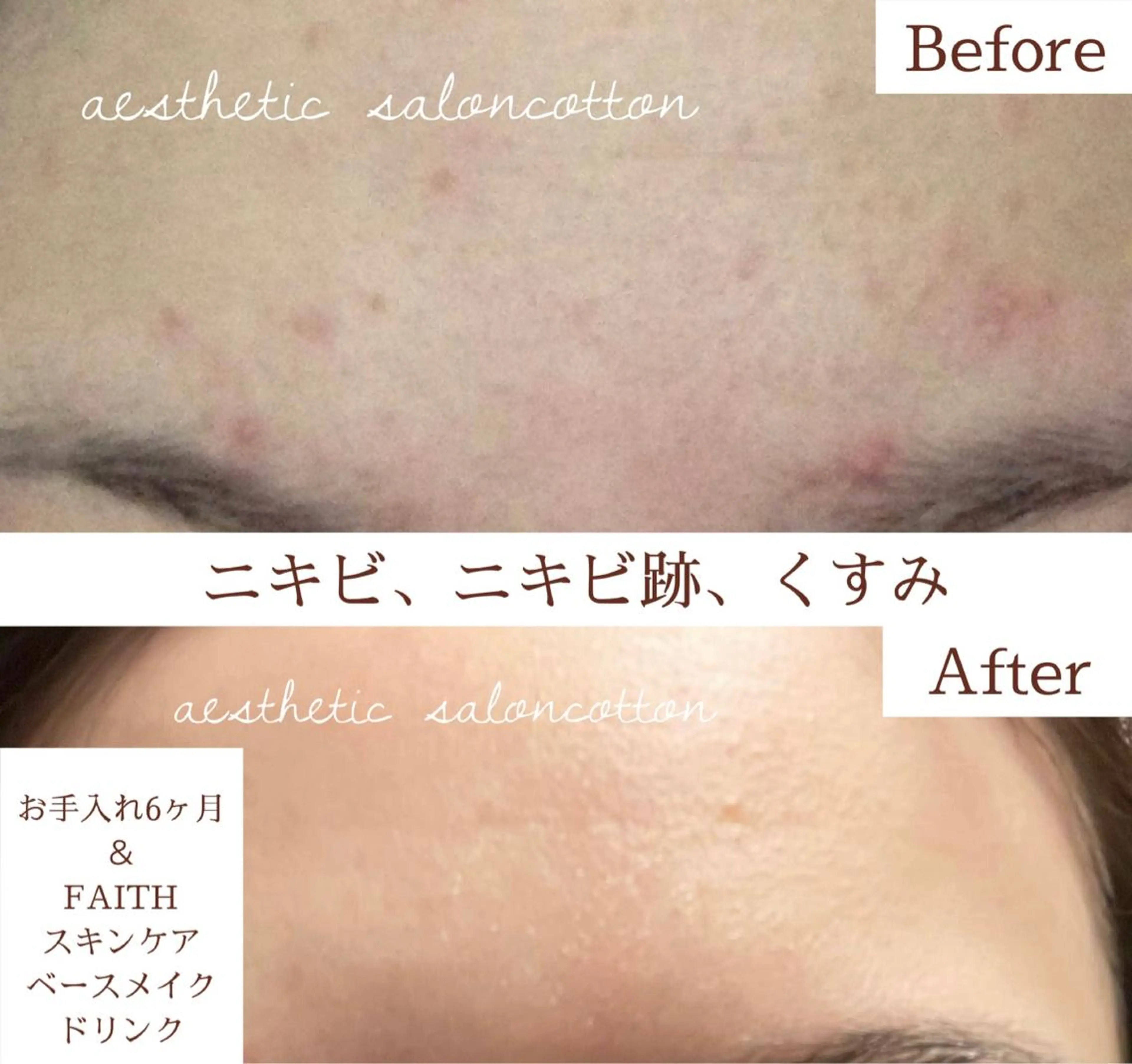 都度払い 肌質改善専門サロンのエステ・リラクイメージ