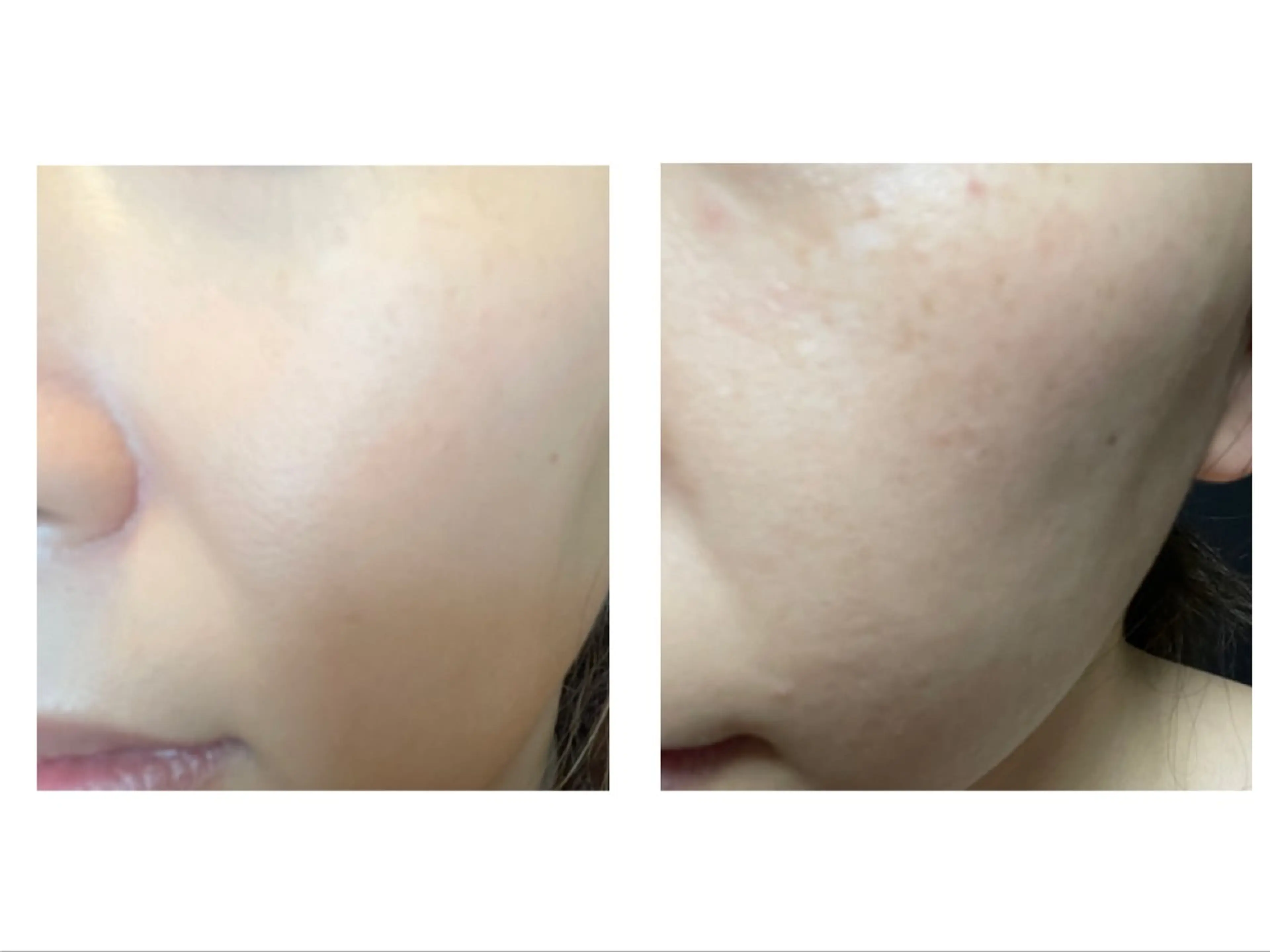 LEMONADE レモネードのエステ・リラクイメージ