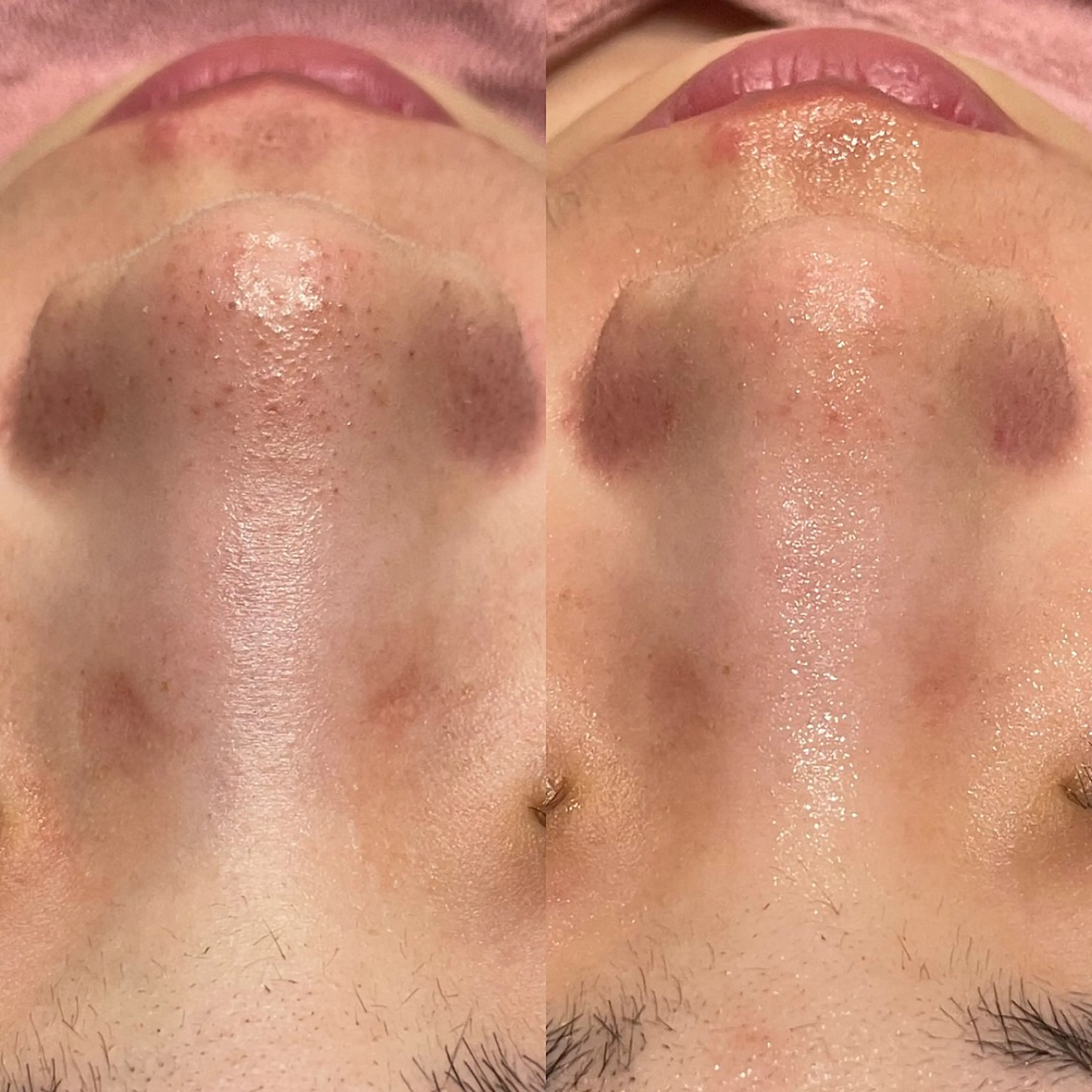 private salon éclat所属・ニキビ・毛穴専門 éclat/エクラのエステ・リラクイメージ