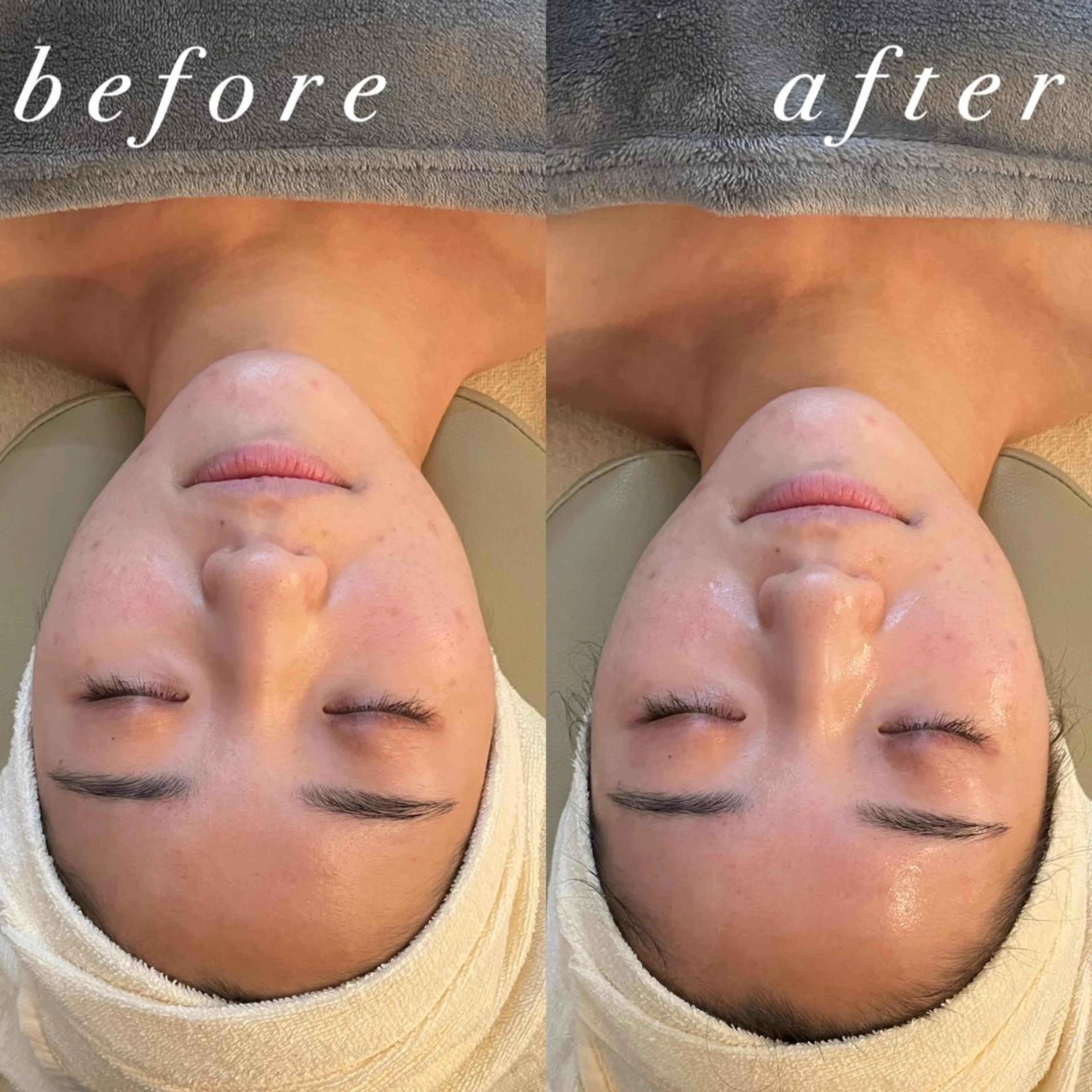 うなじ脱毛/美肌脱毛 LABELのエステ・リラクイメージ