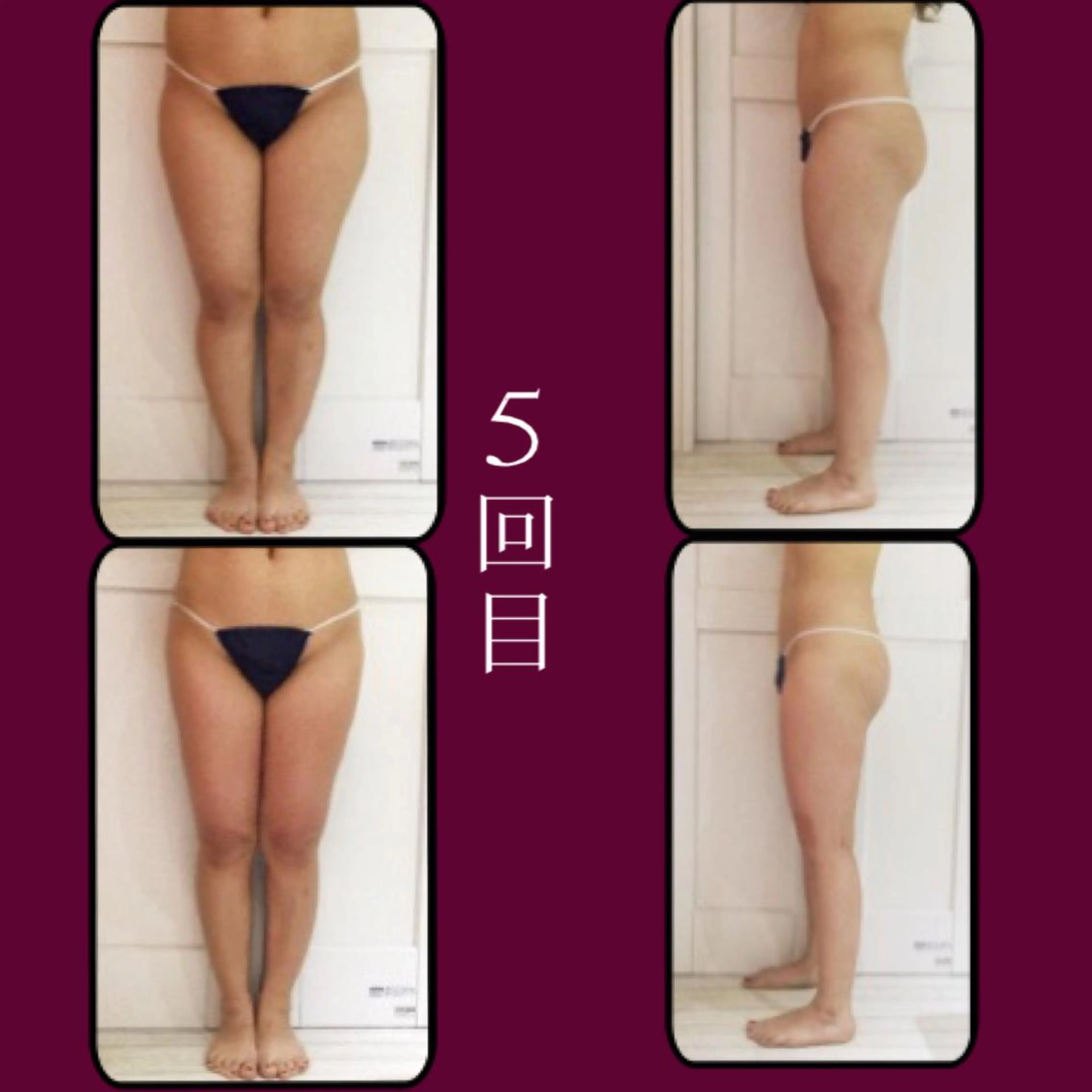 代表 MOMOのエステ・リラクイメージ