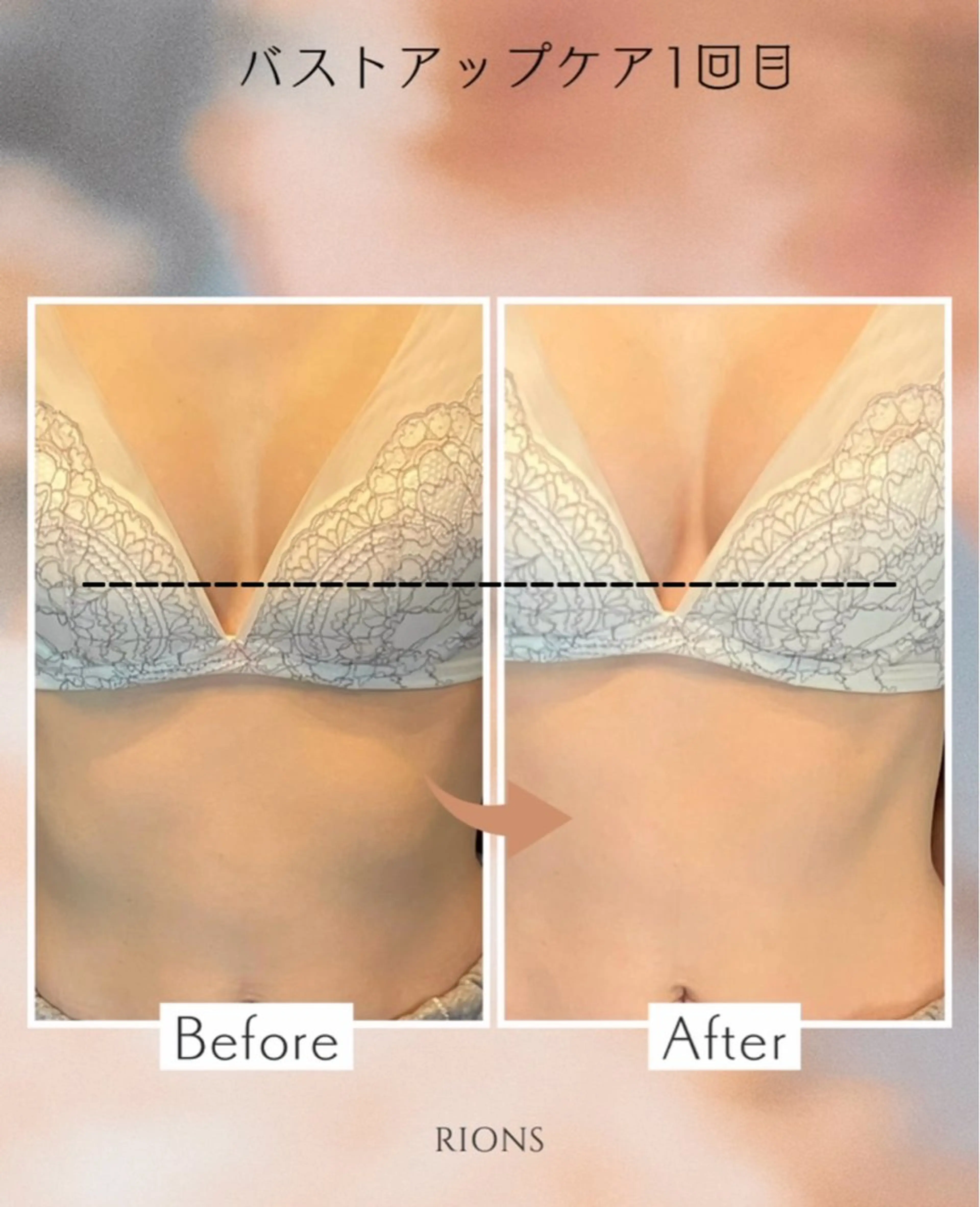 private salon Rions所属・堺市バストアップ特化 サロンRIONSのエステ・リラクイメージ