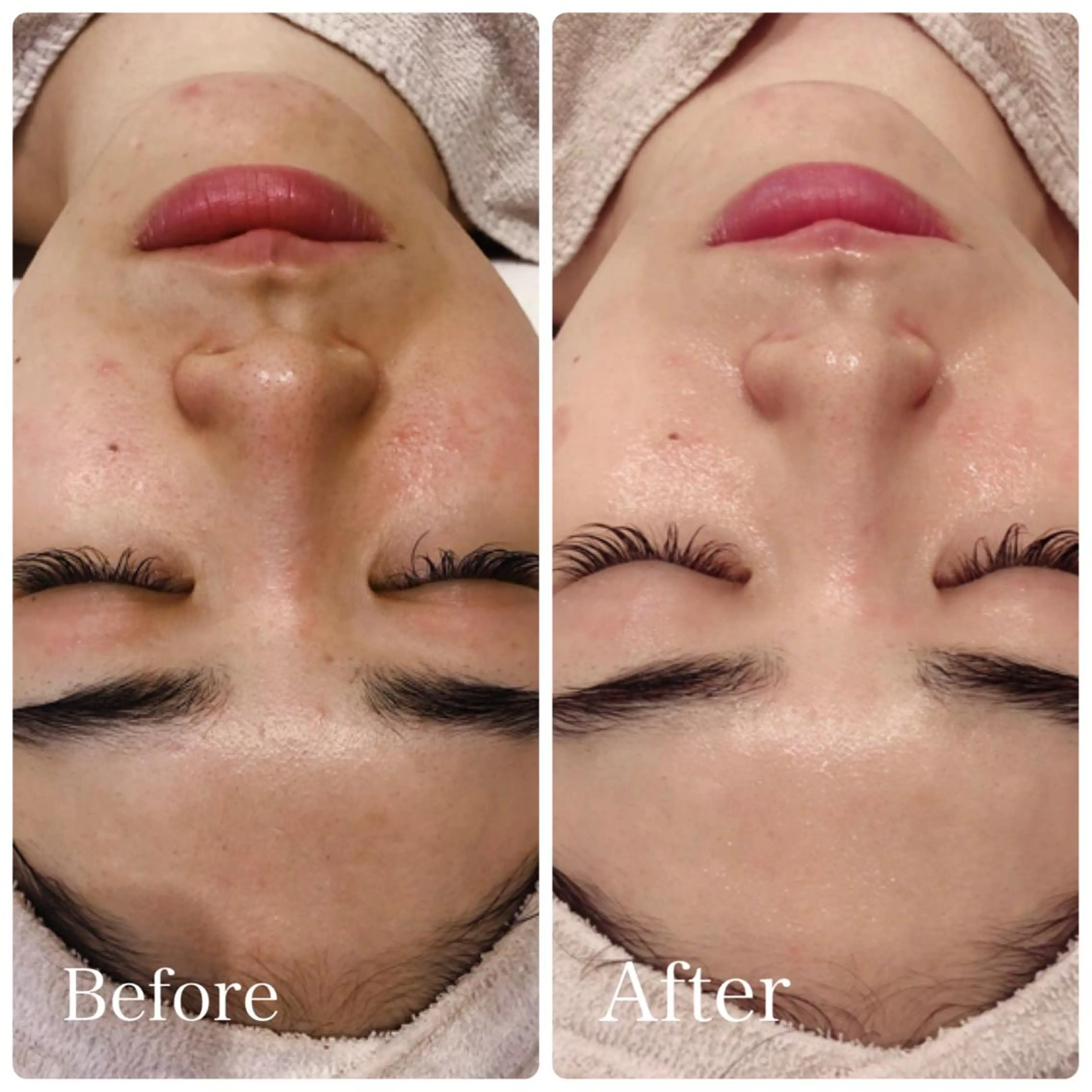 エステ L’Beige レベージュのエステ・リラクイメージ