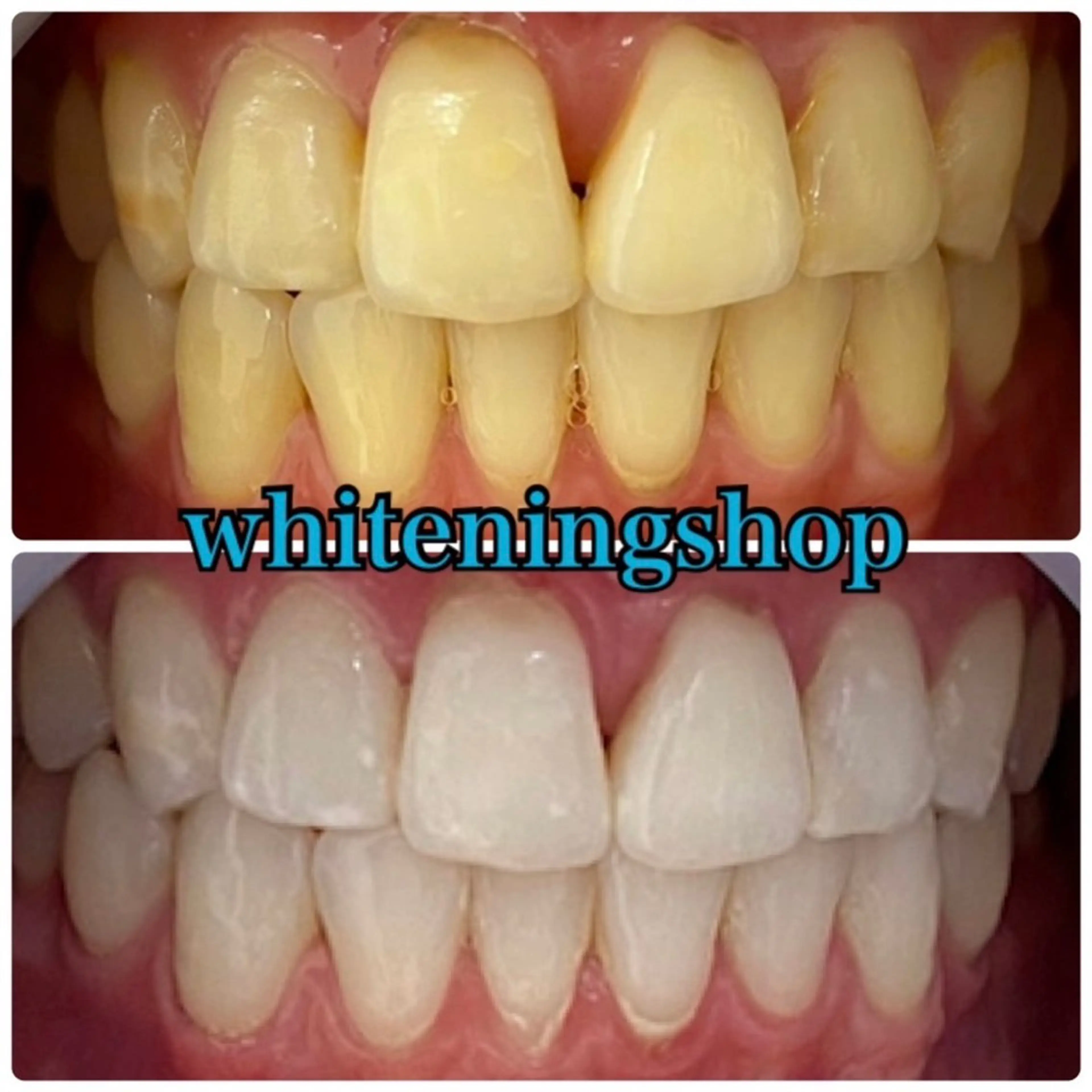 エステ リラク ホワイトニング ショップ吉祥寺店のエステ・リラクイメージ