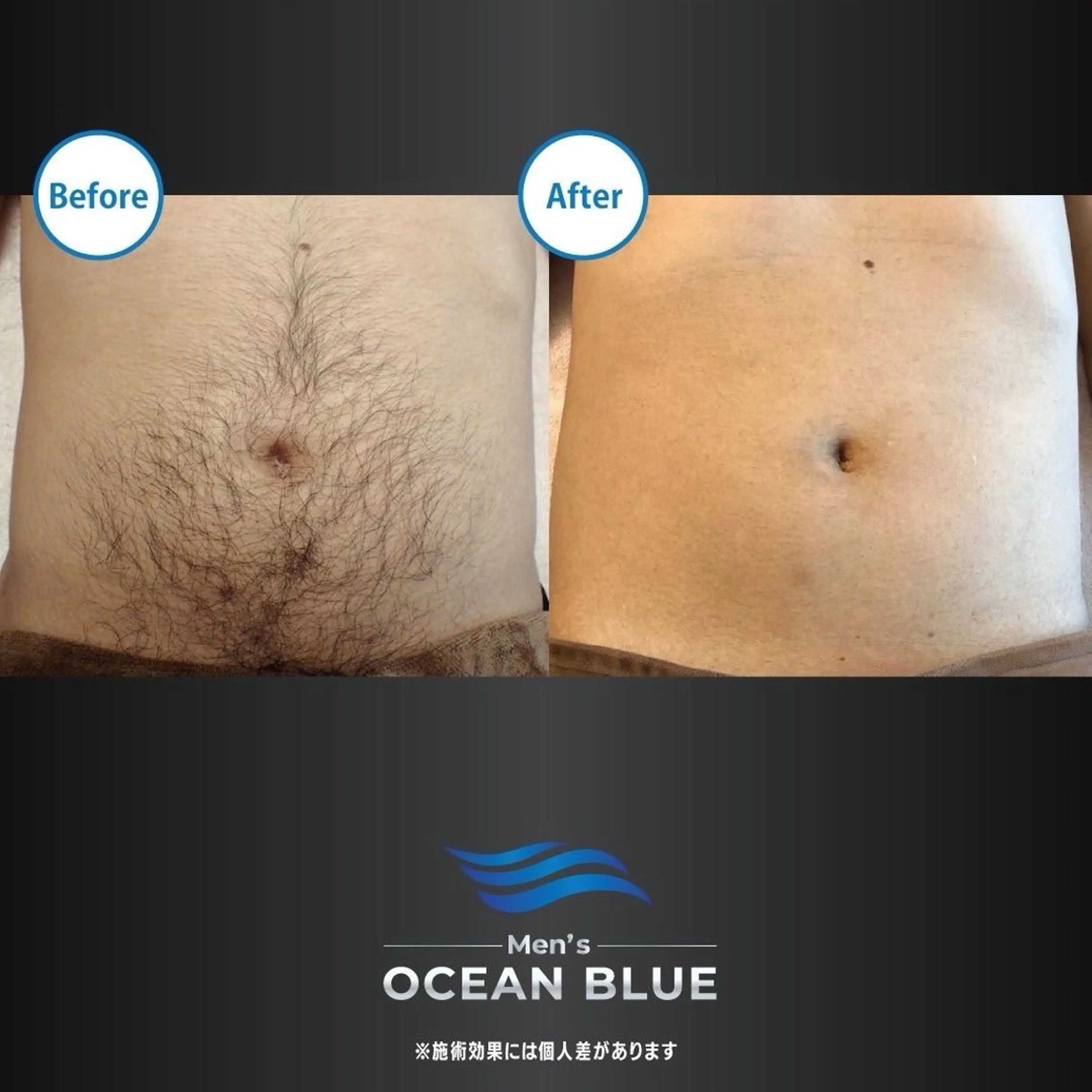 メンズ メンズオーシャンブルー福岡店所属・柿添 希実のエステ・リラクイメージ