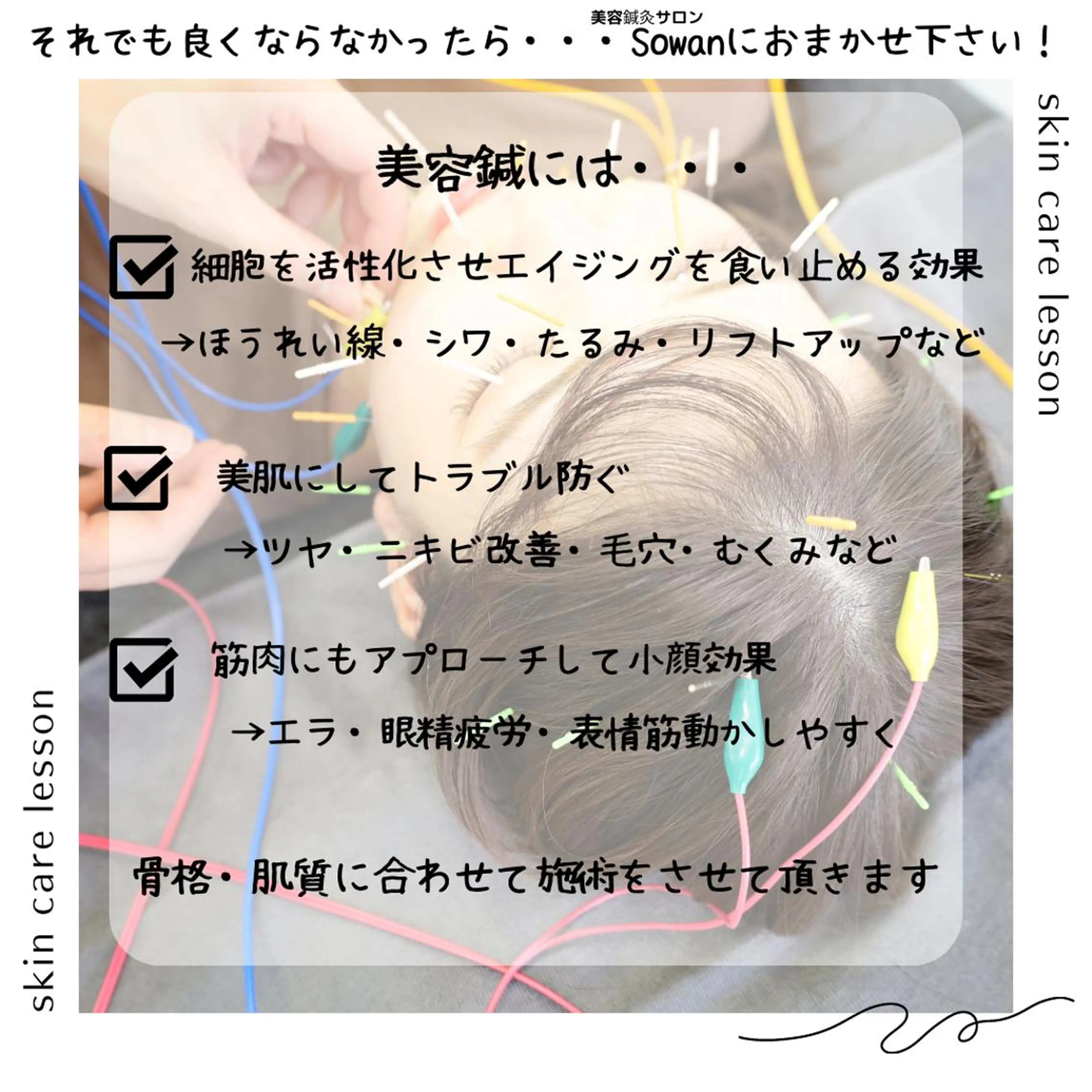 ニキビ特化美容鍼 ×ハーブピーリングのエステ・リラクイメージ