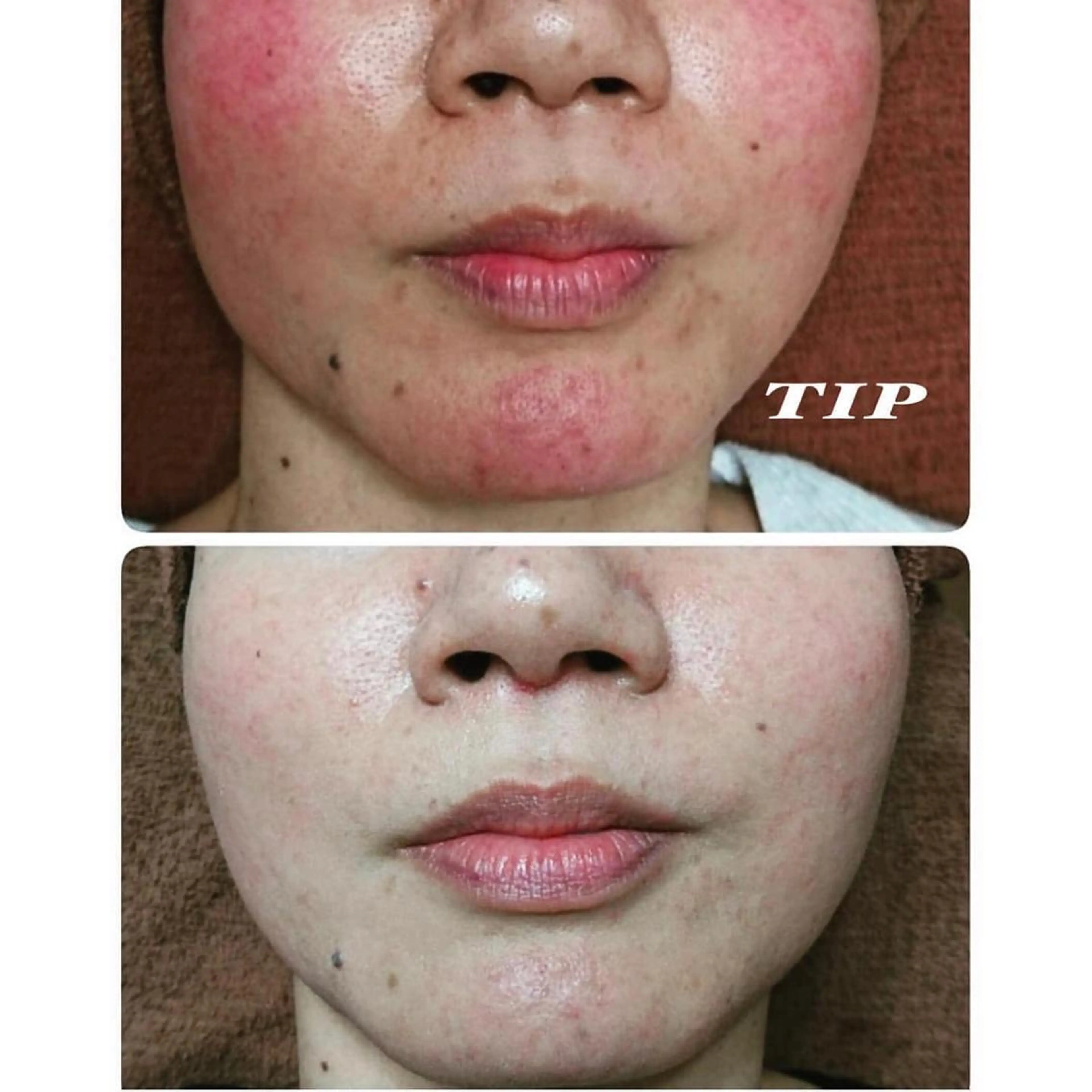 エステ フェイシャル専門 肌質改善/プランスのエステ・リラクイメージ