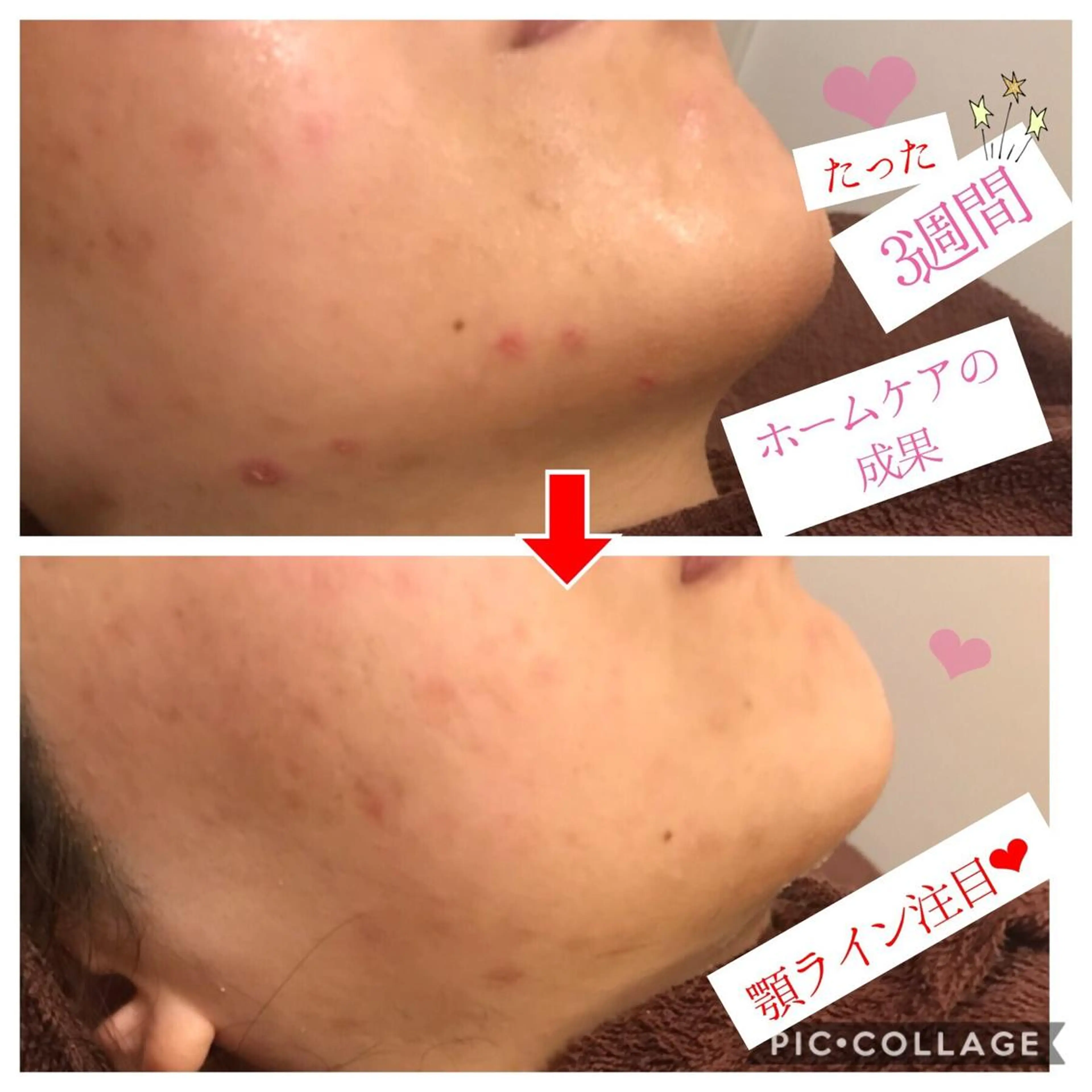 ミディアム カラー パーマ ヘアアレンジ メンズ キッズ ネイル マツエク・マツパ 四つ星サロン🎖 腸＆ニキビケアに特化のエステ・リラクイメージ