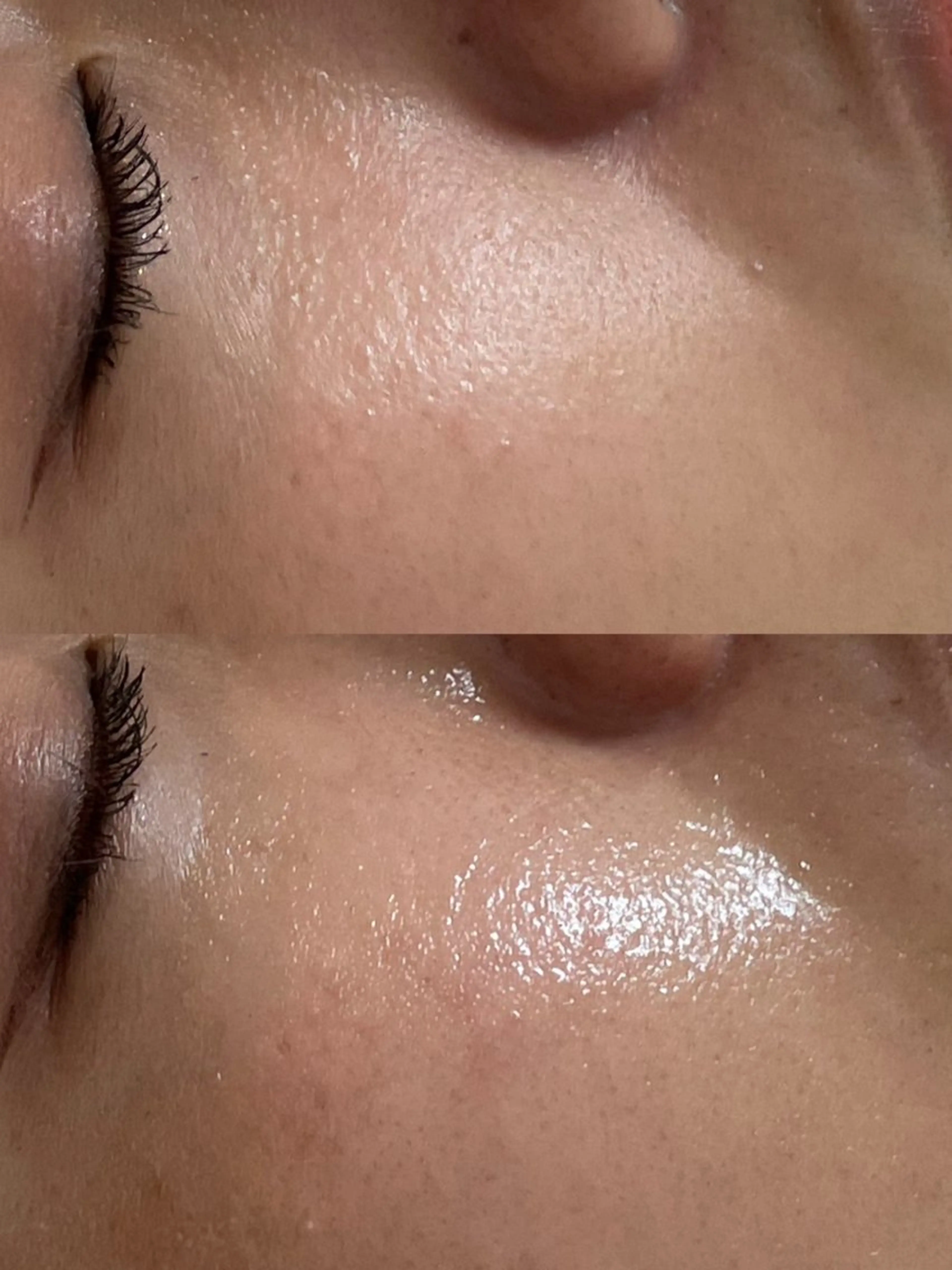 private salon éclat所属・ニキビ・毛穴専門 éclat/エクラのエステ・リラクイメージ