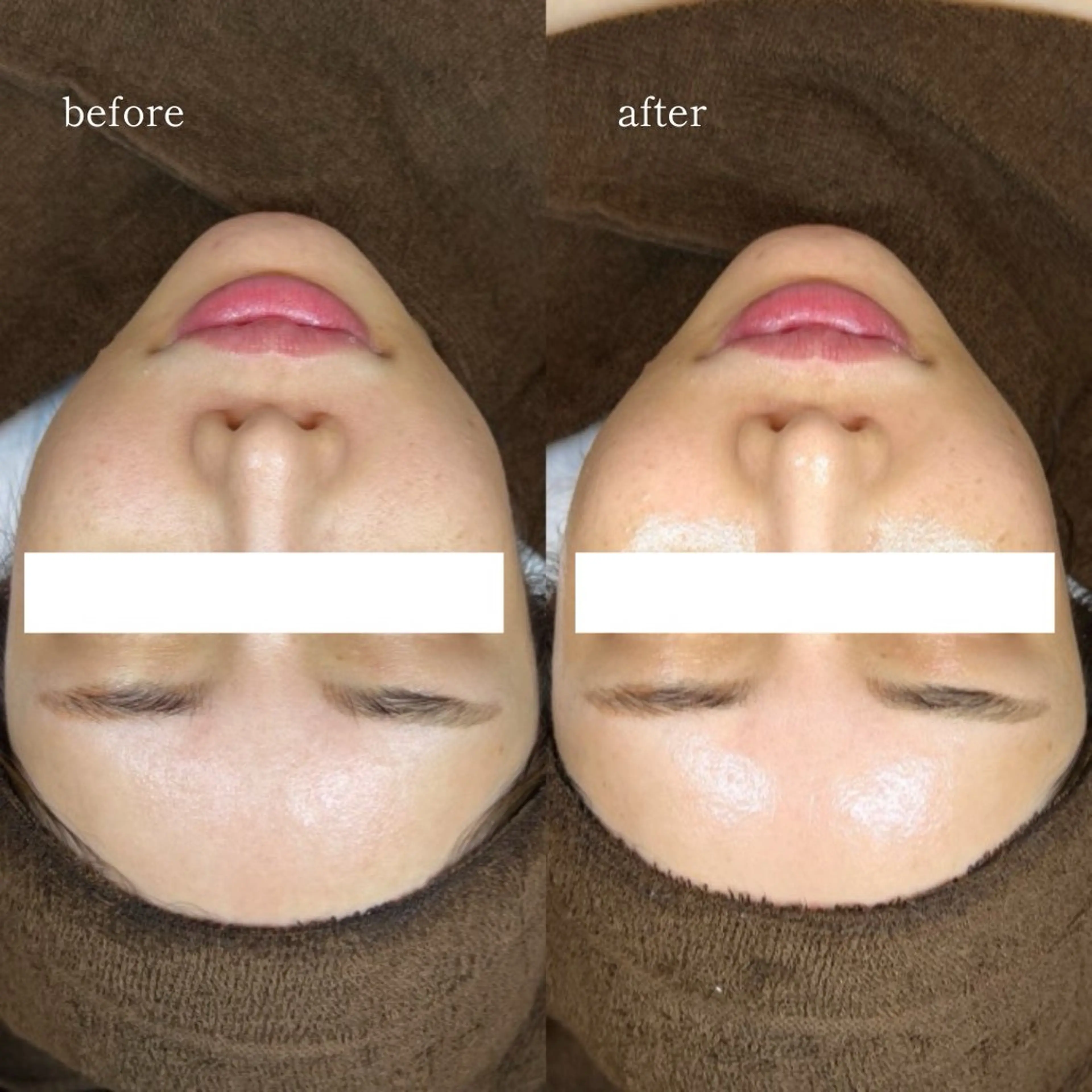 エステ 【韓国人肌製作所】 水光肌ならアーネストのエステ・リラクイメージ