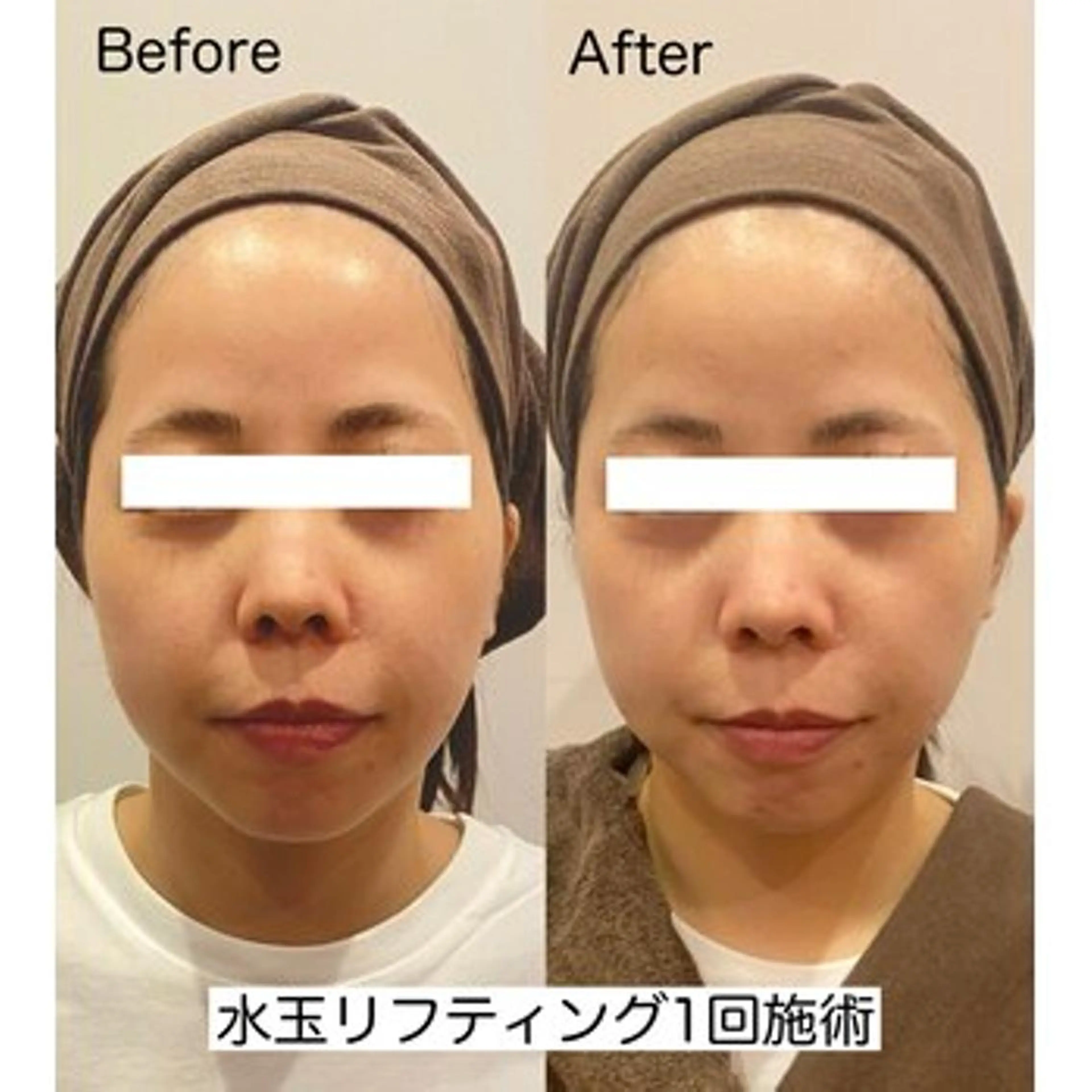 脱毛＆小顔；ミアンカ 京橋京阪モール店のエステ・リラクイメージ