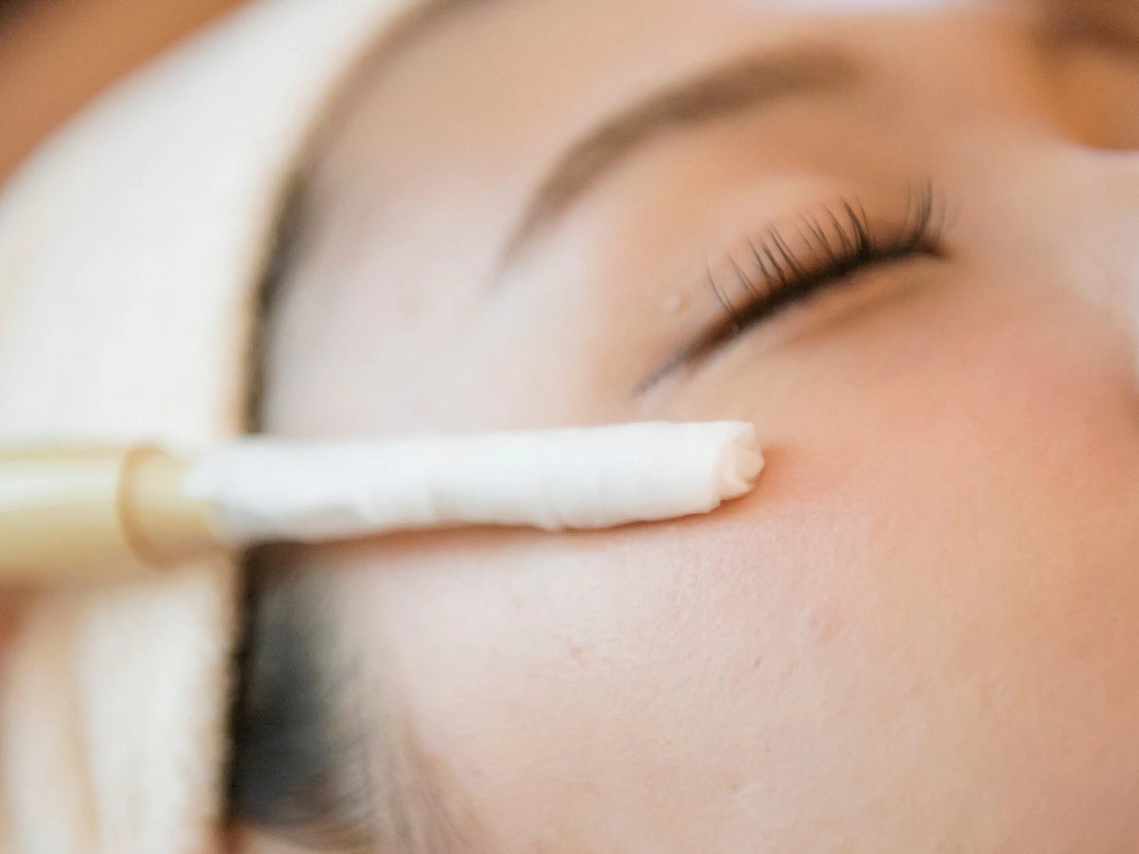 【💛夏の日焼けケアに🤎】イオン導入3回で9,900円の写真