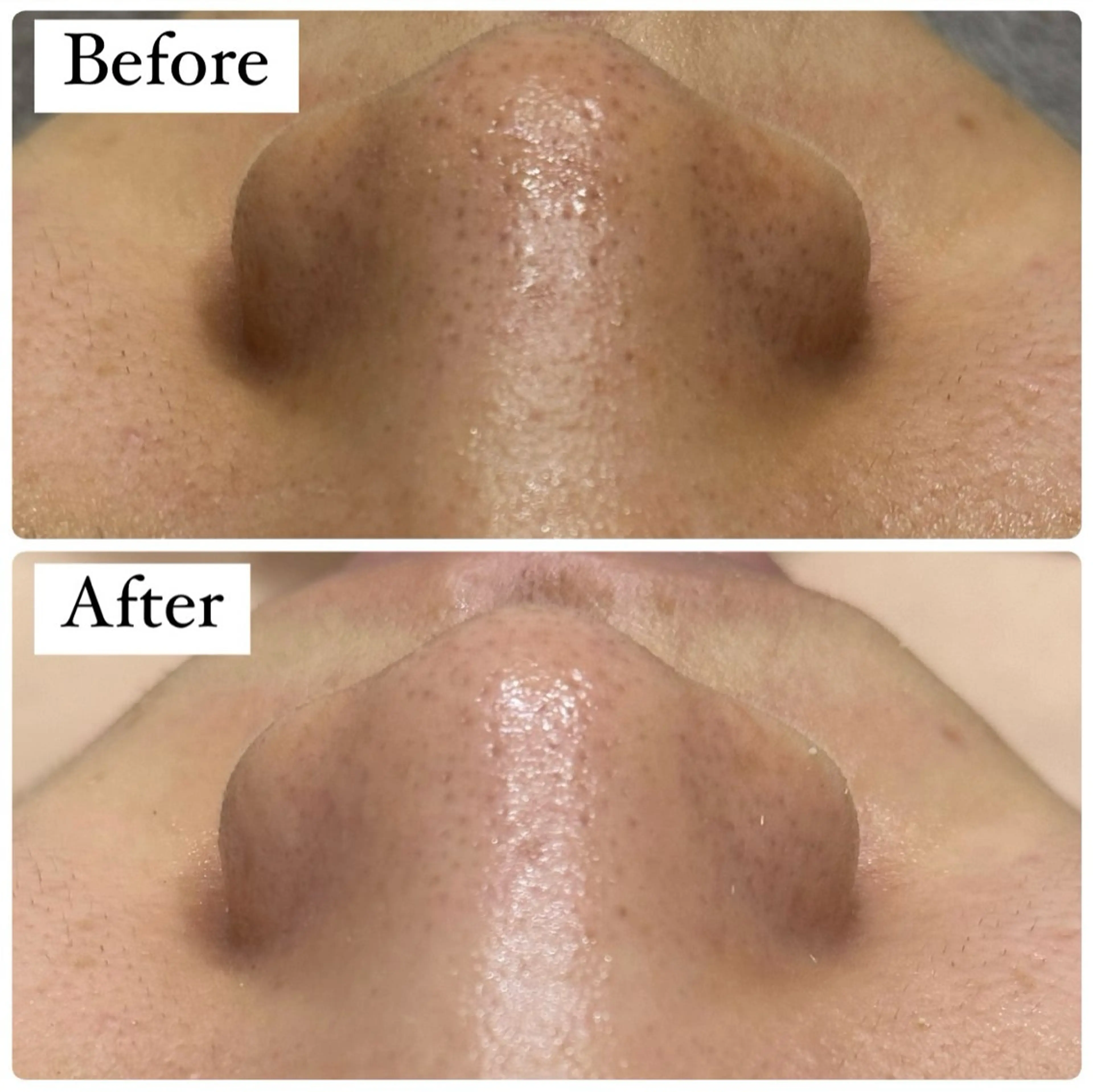 ハーブピーリング専門 muro.のエステ・リラクイメージ