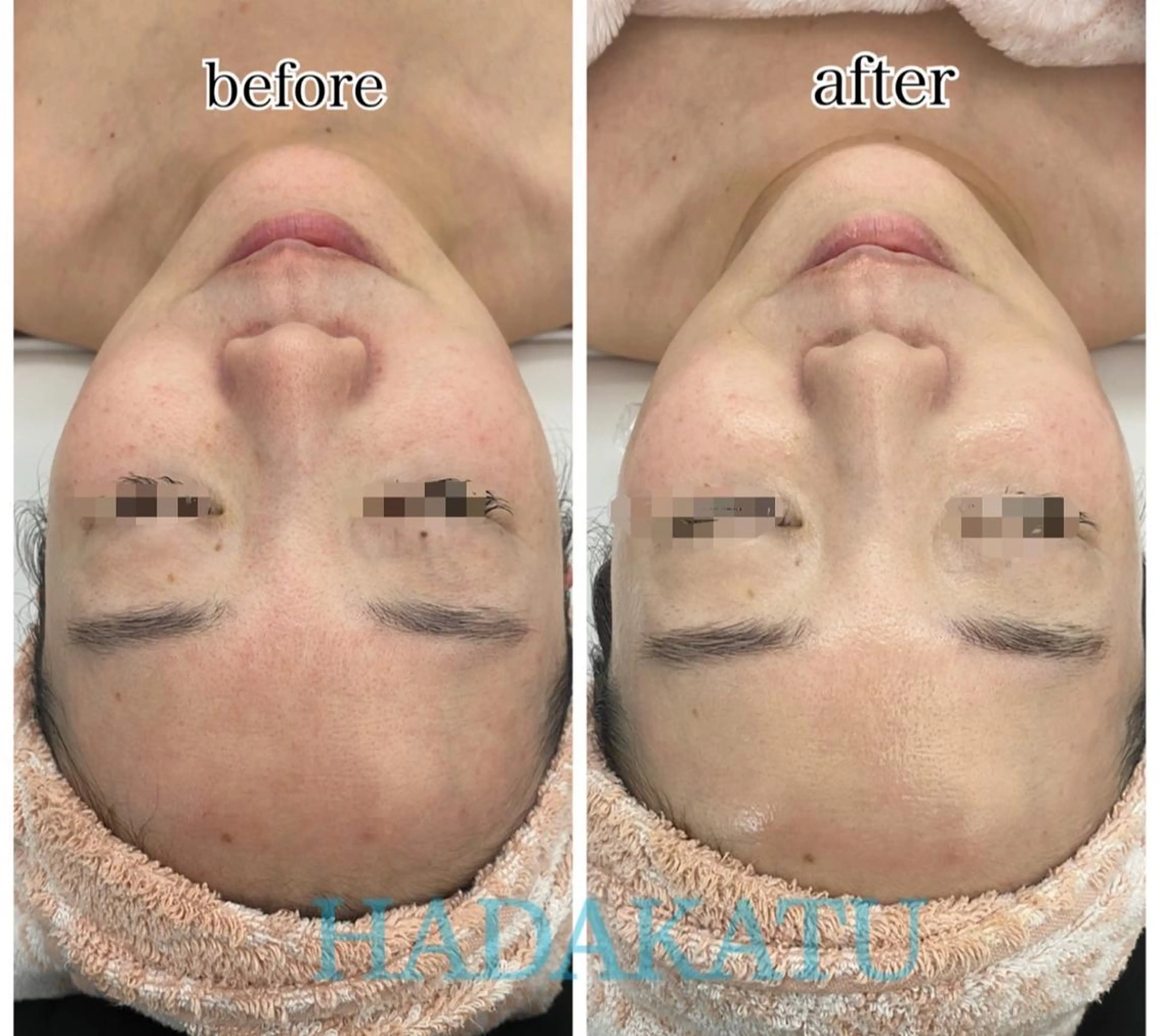 総合エステサロン 肌活のエステ・リラクイメージ