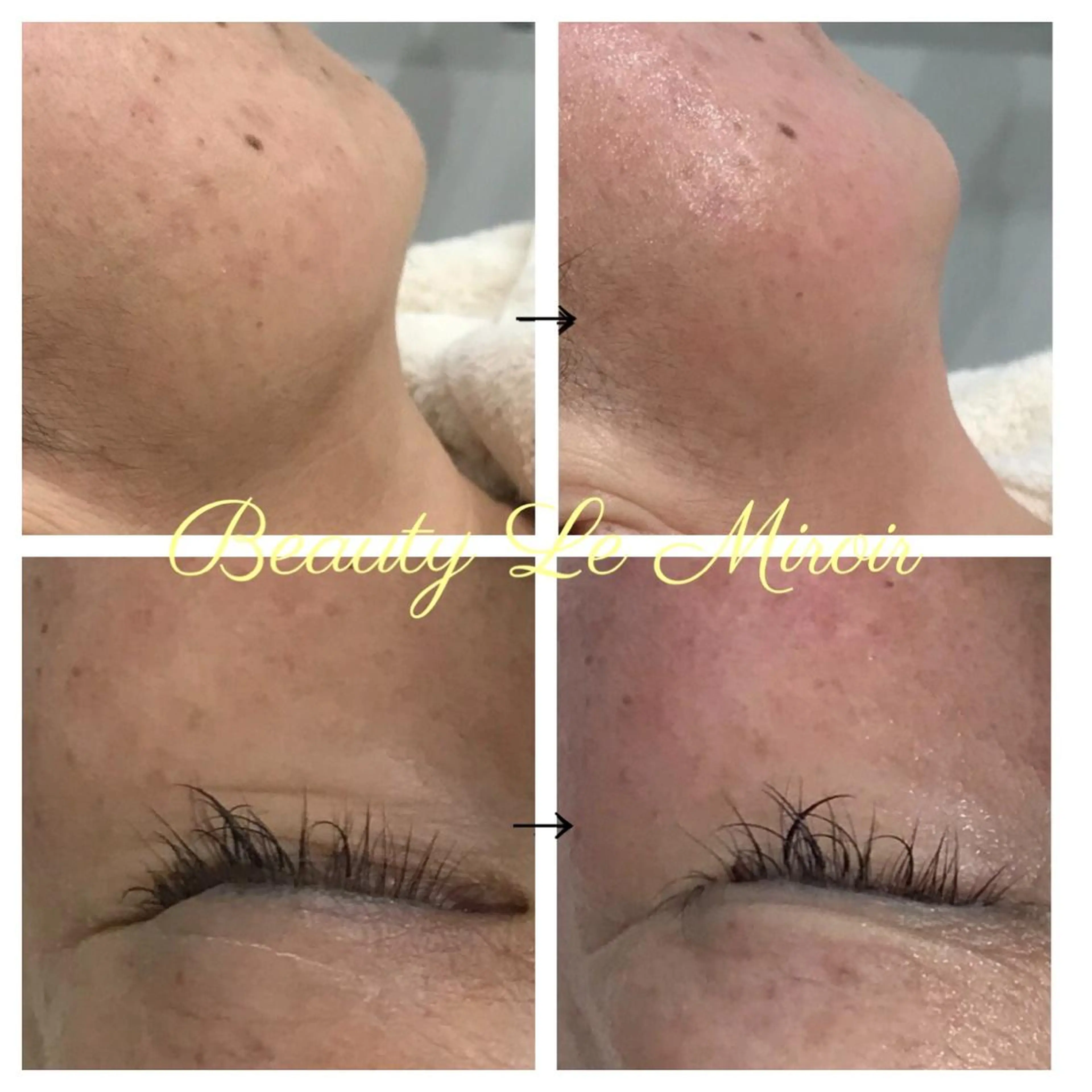 ビューティー ミロワールのエステ・リラクイメージ