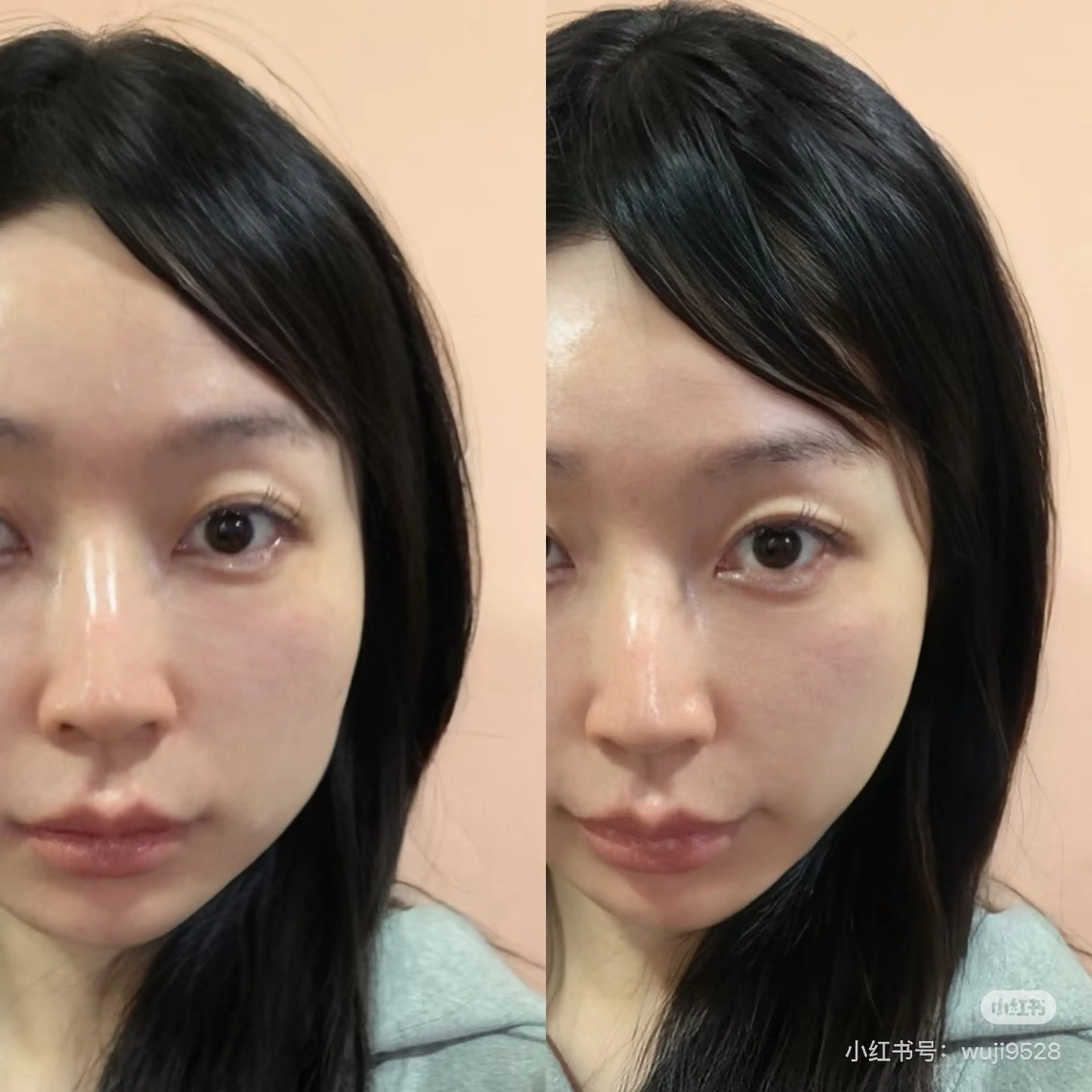 マツエク・マツパ エステ aliaハイフ&水光ジェットサロン所属・aliaハーブ水光店 エステティシャン募集のエステ・リラクイメージ