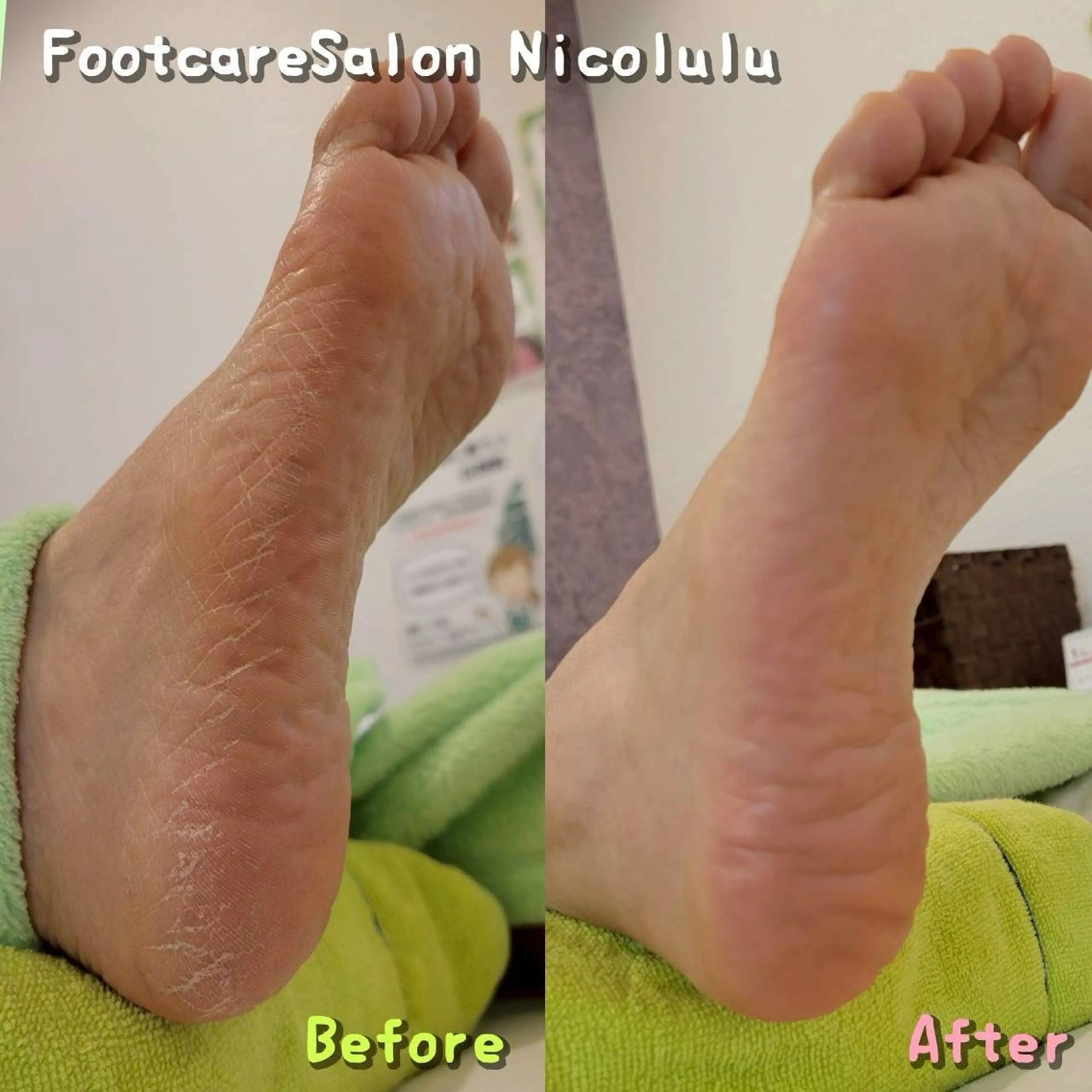 リラク 足トラブル専門 ニコルル金沢のエステ・リラクイメージ