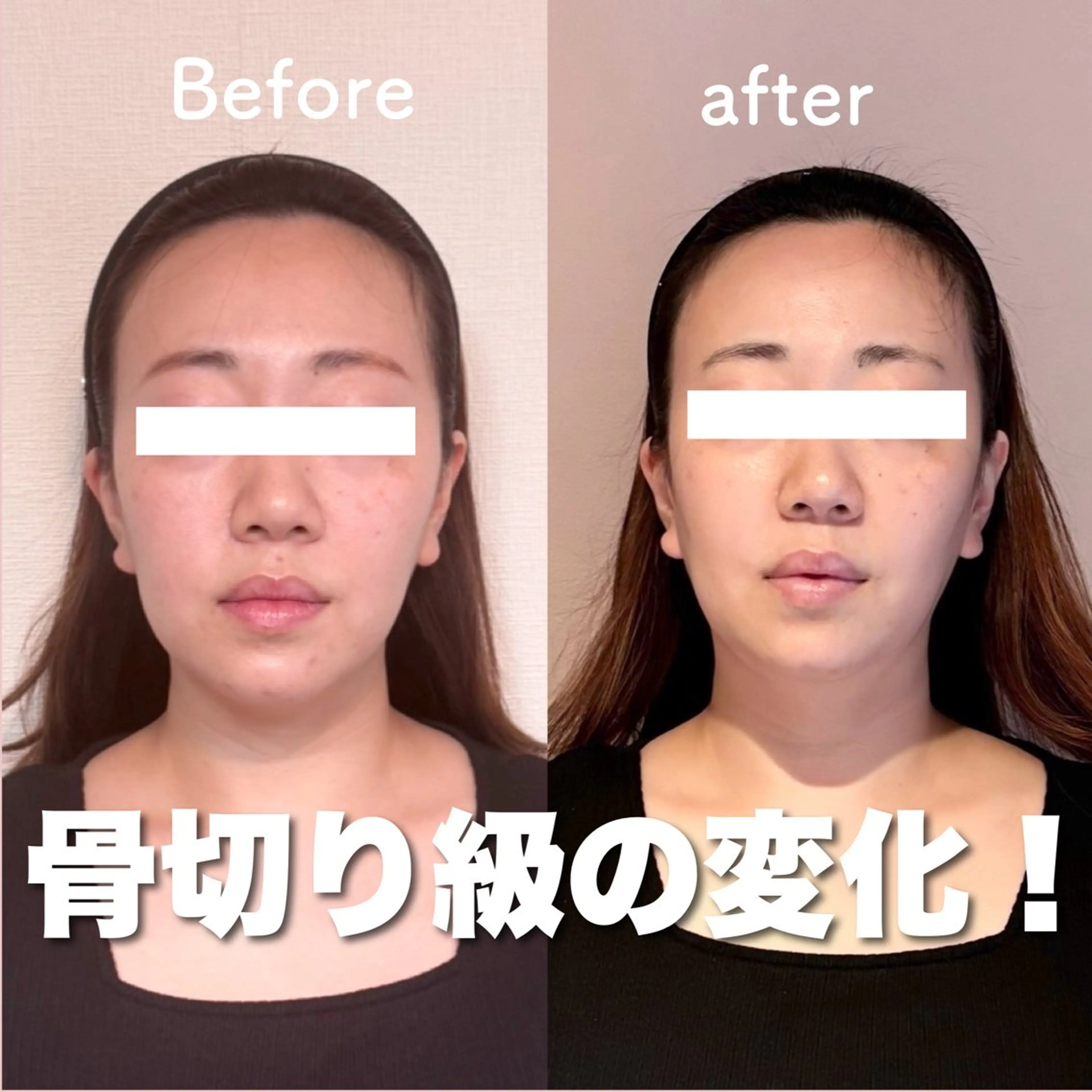 【人気No.1】整形級小顔へ！！ヘッドスパ＋オーダーメイド小顔矯正＋小顔オイルリンパの写真