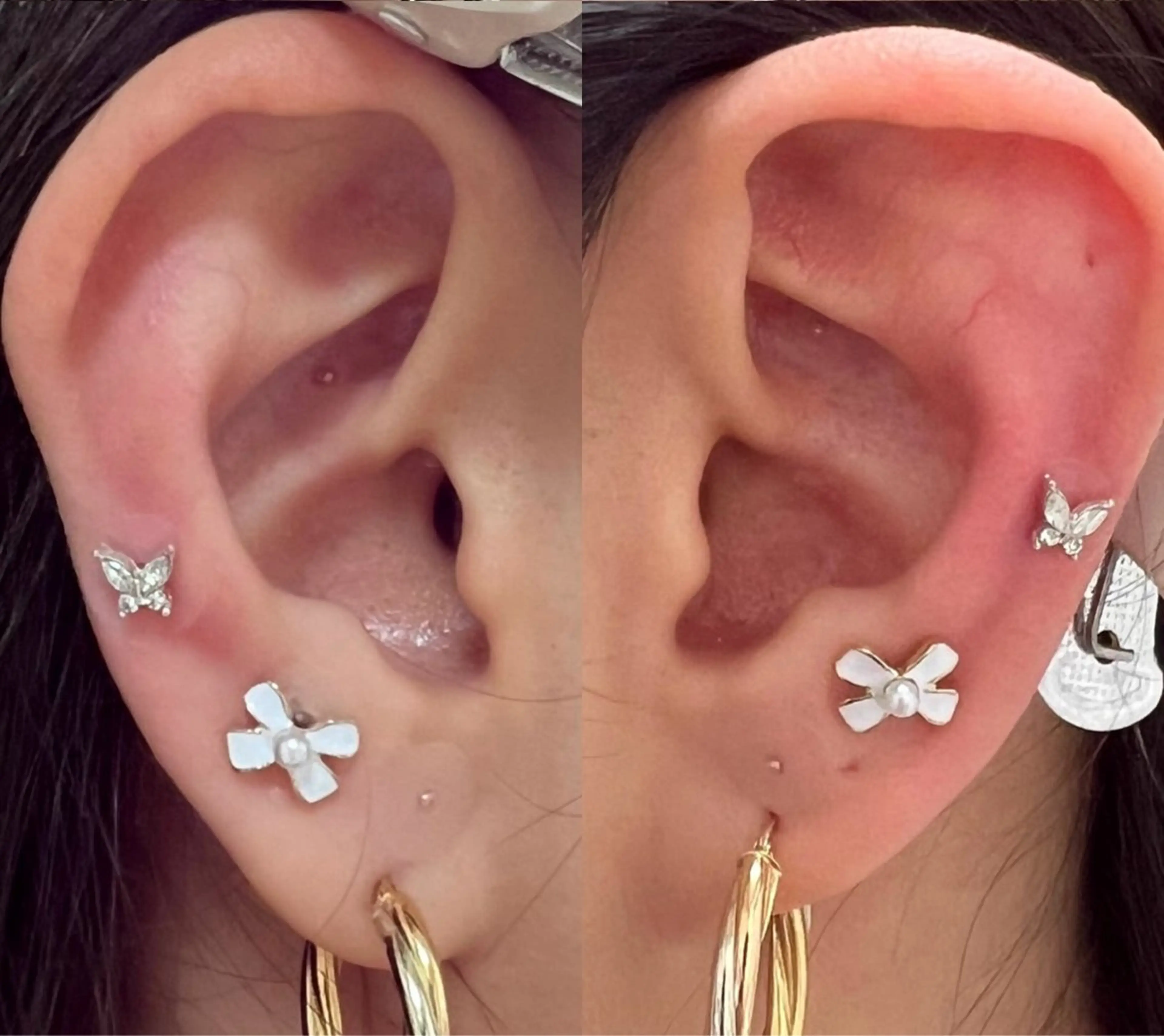 エステ リラク ホワイトニングショップせんげん台店所属・スタッフ 兎洞のその他イメージ