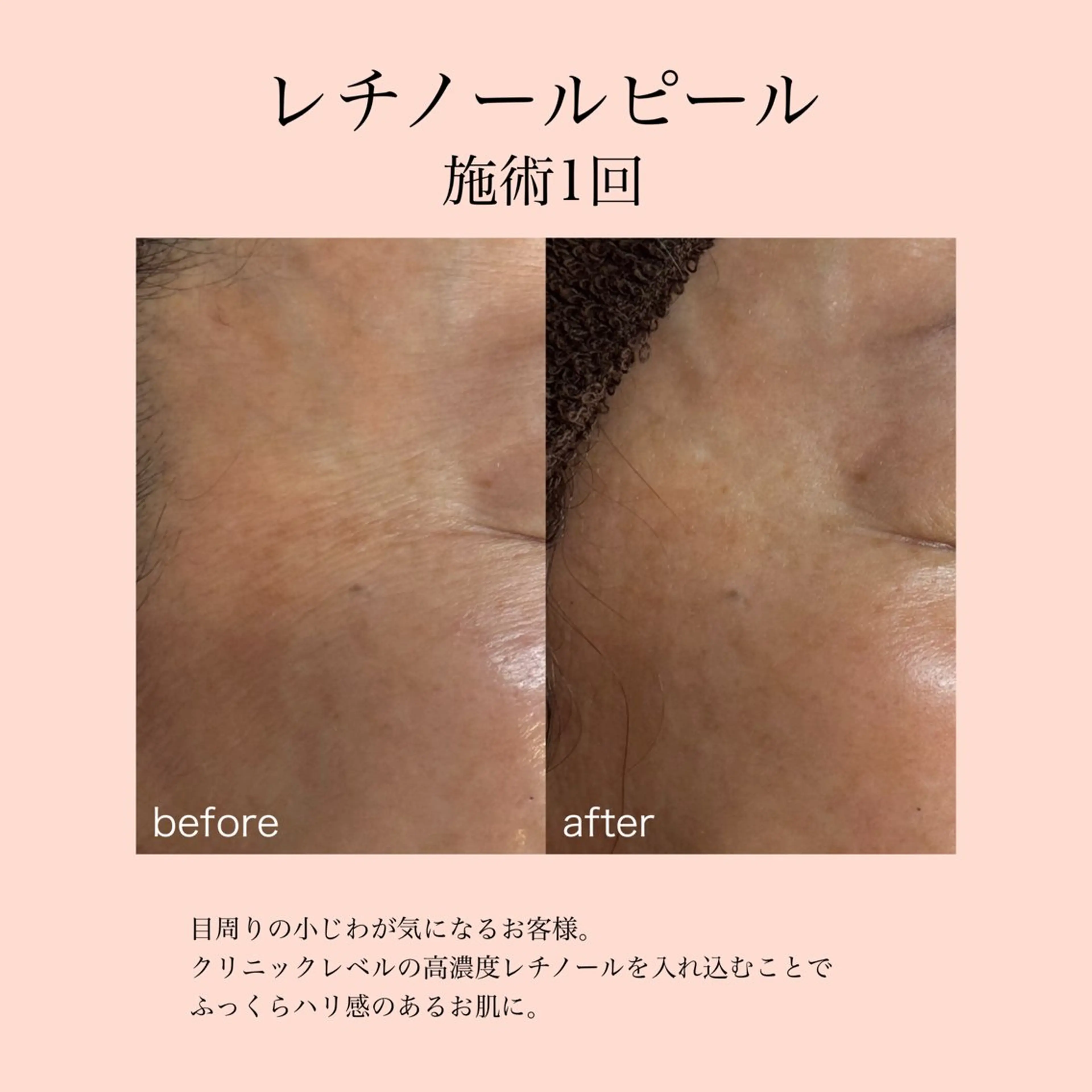 エステ 【結果が出る肌管理】 Ryanのエステ・リラクイメージ