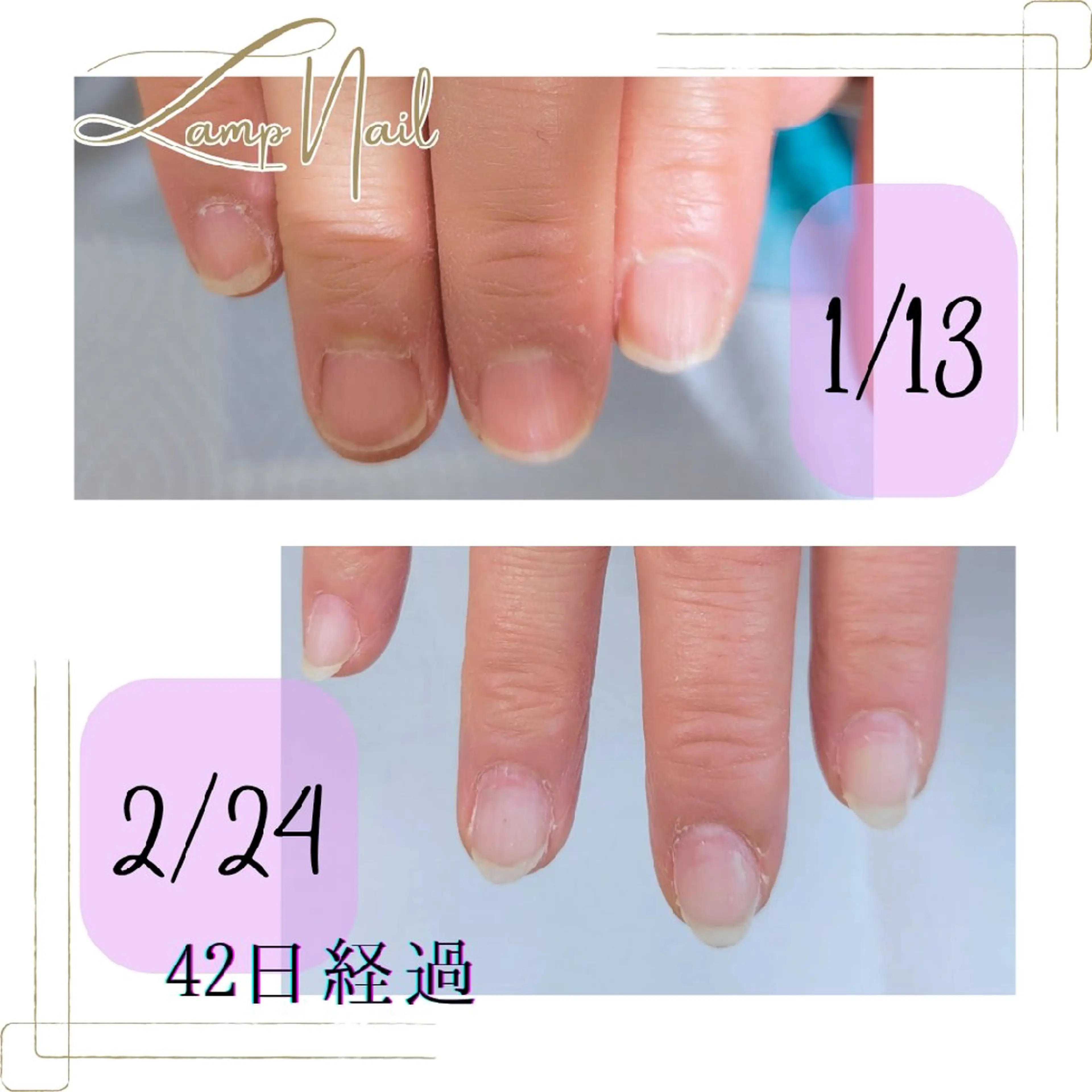 美爪育成💅深爪・むしり爪・噛み爪の写真