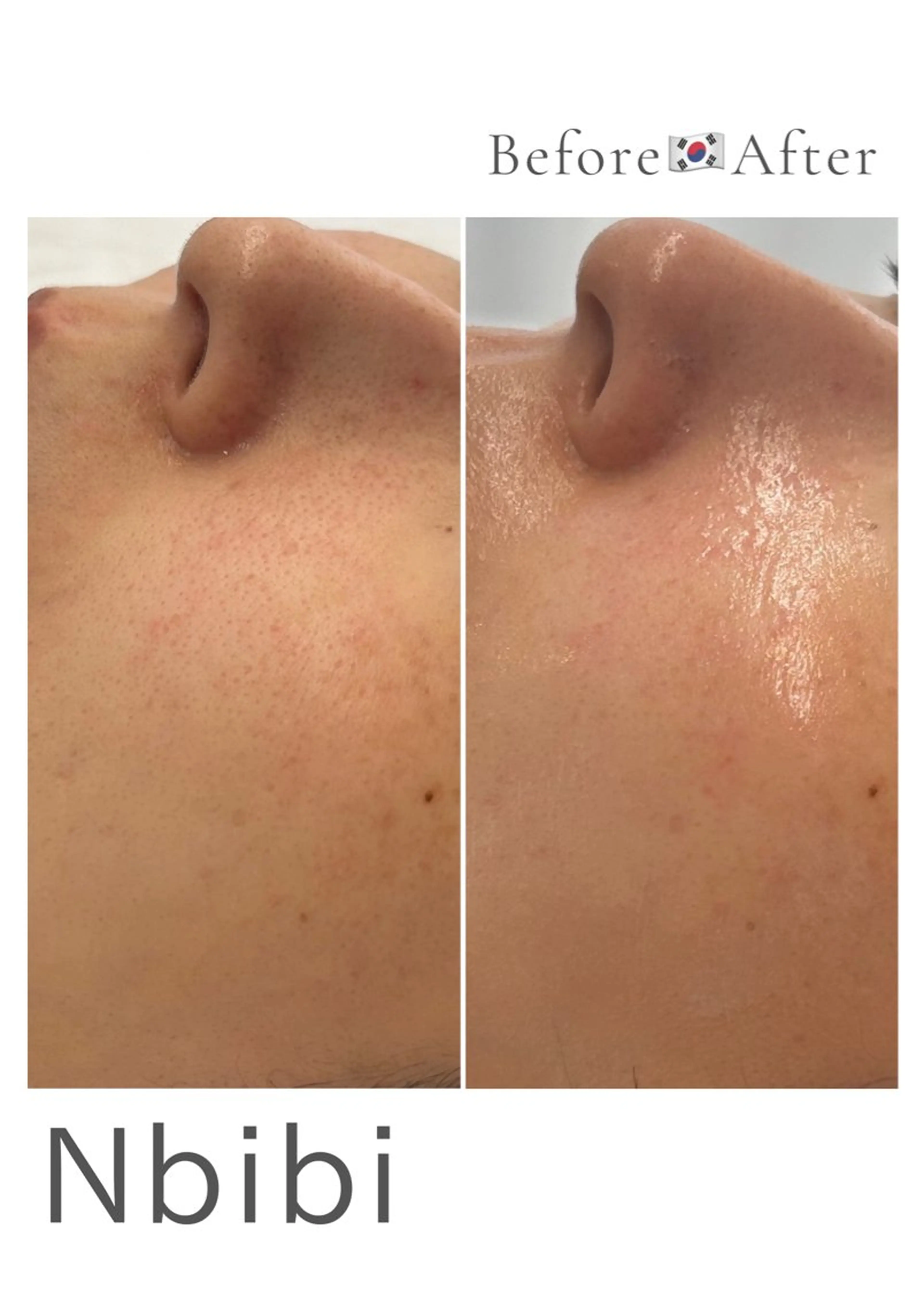 韓国🇰🇷価格 サロン_Nbibiのエステ・リラクイメージ