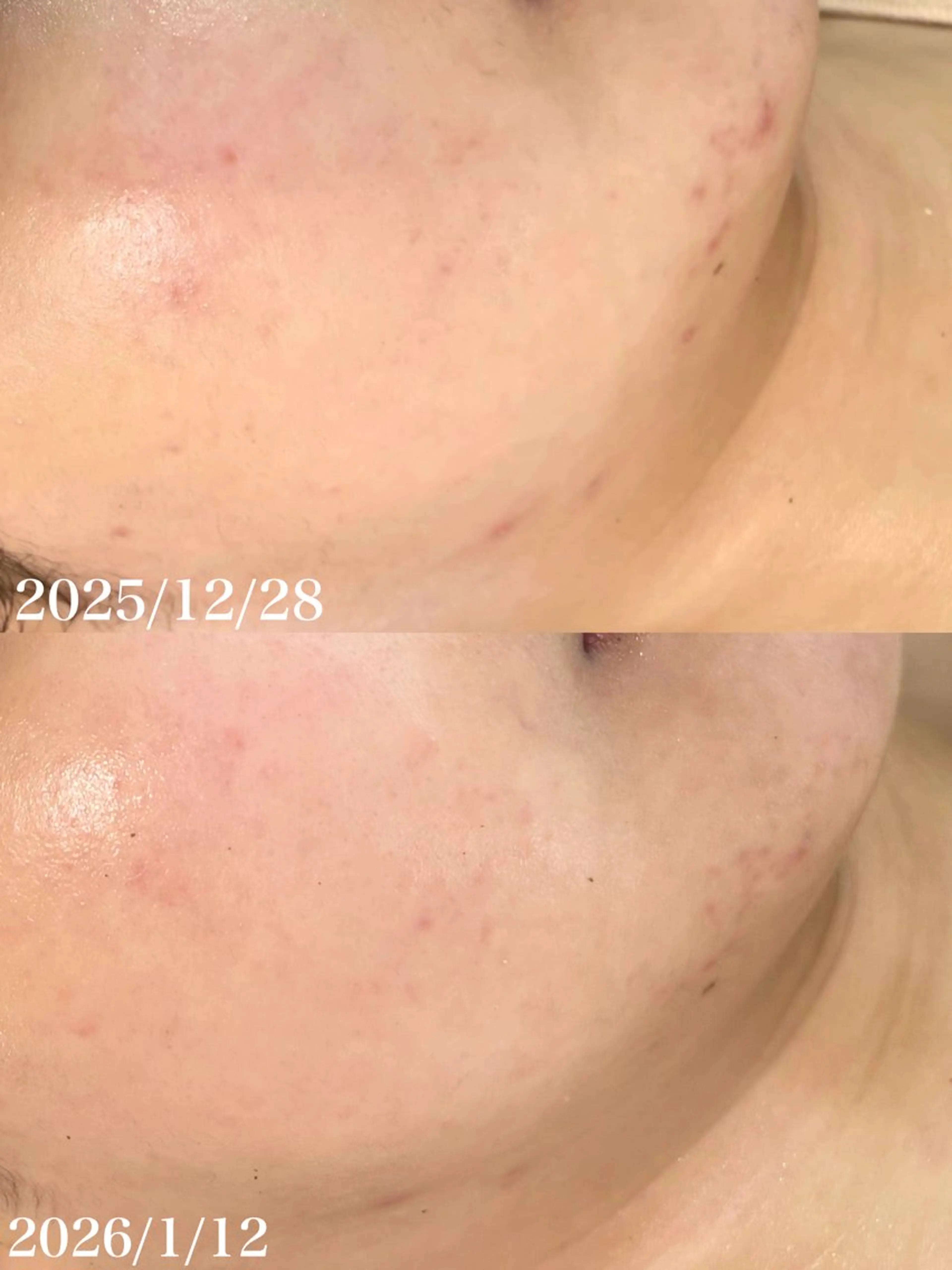 エステ WHITE AQUA 北千住店のエステ・リラクイメージ