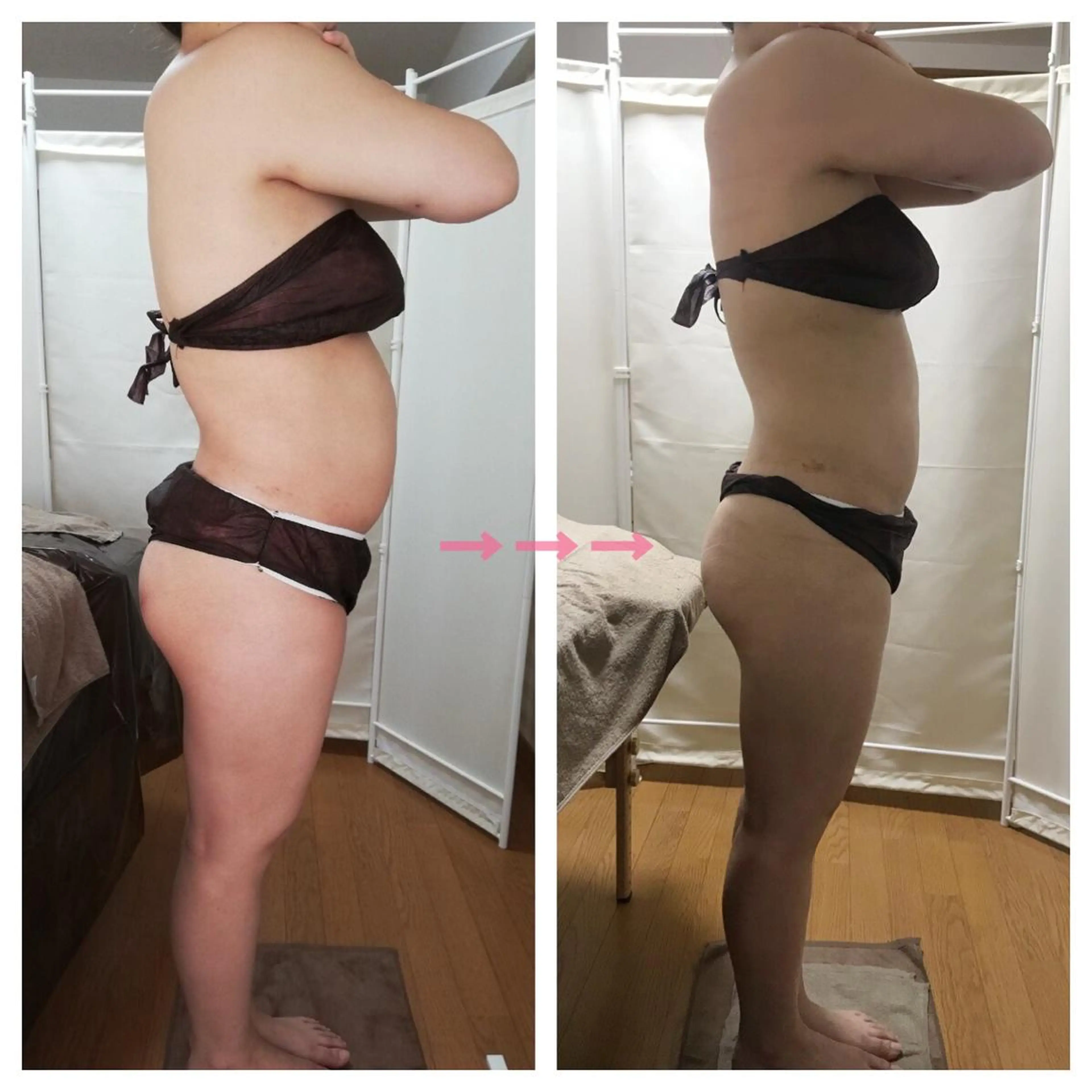 biloop所属・《痩身×疲労改善》 BILOOPのエステ・リラクイメージ