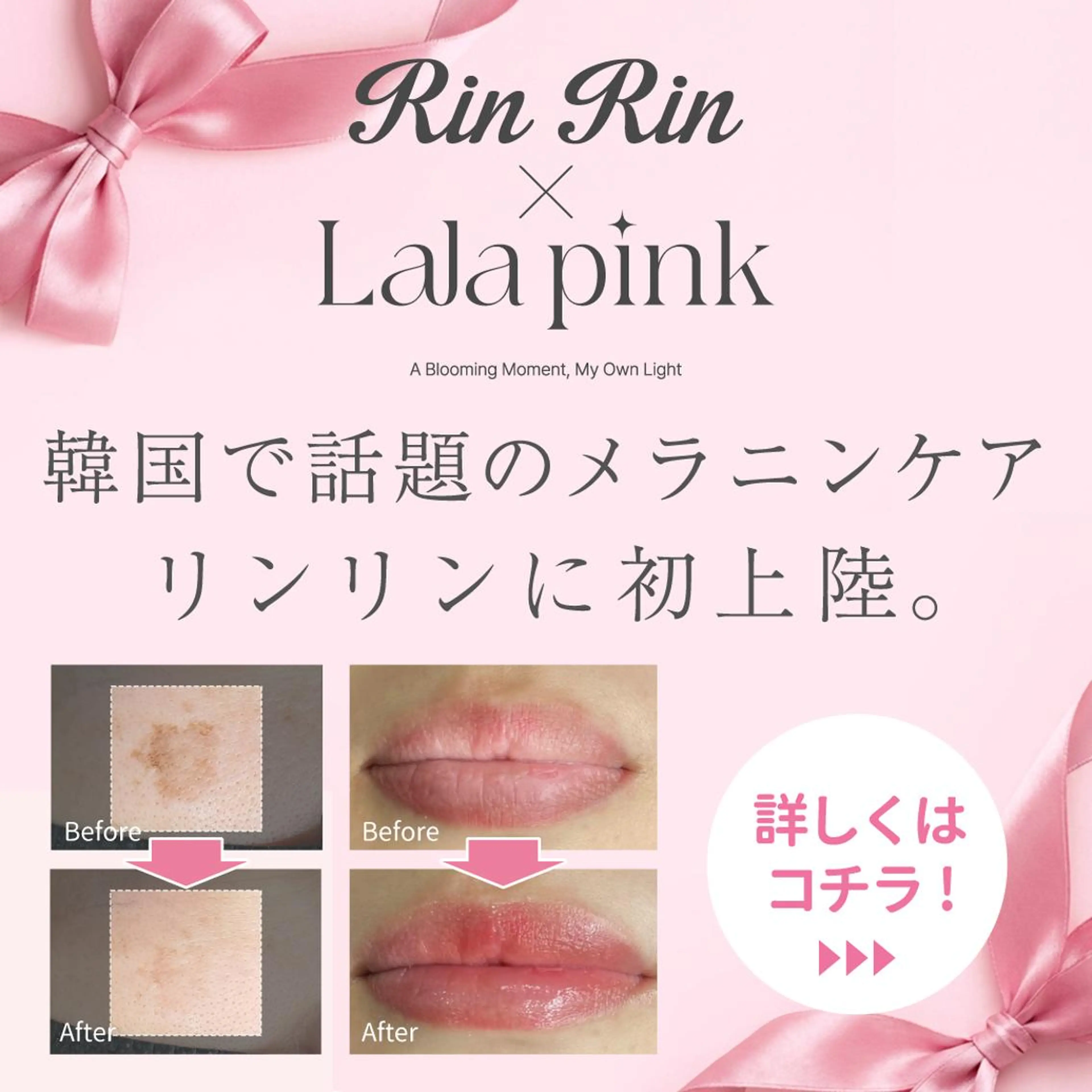 RinRin  福山店のエステ・リラクイメージ