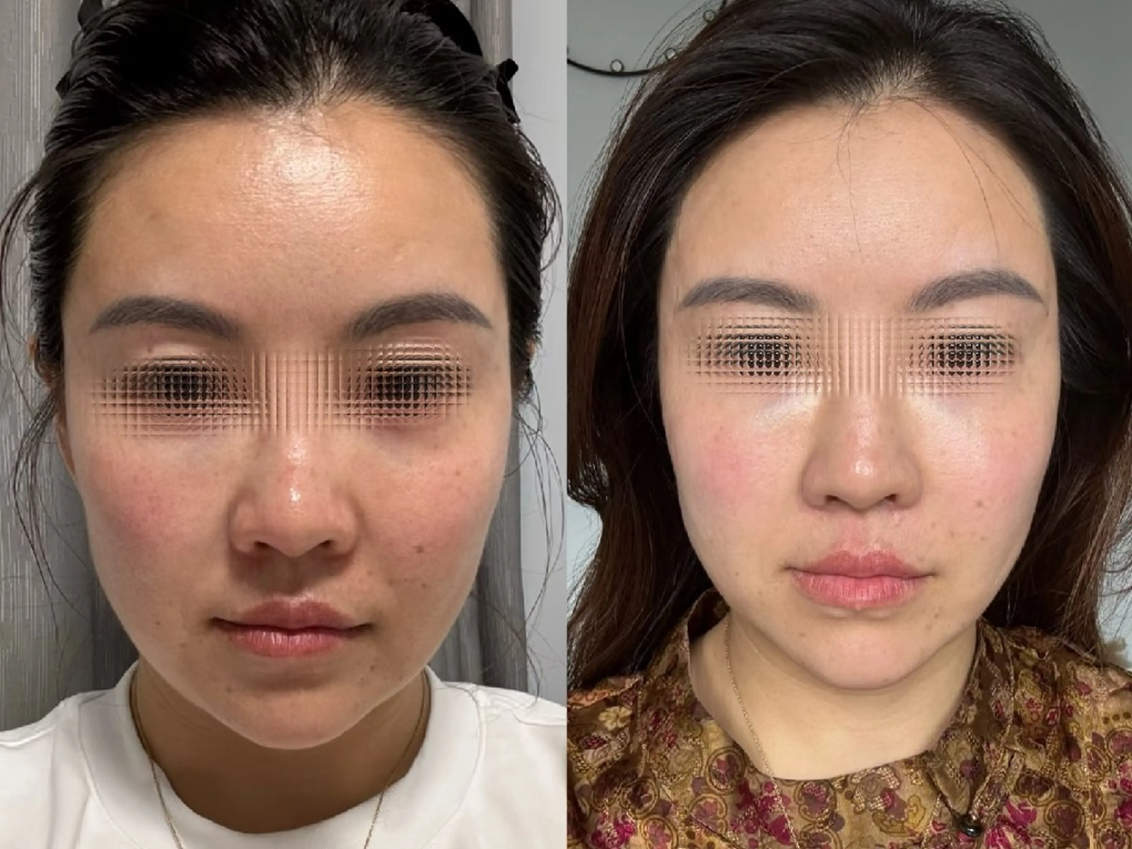 マツエク・マツパ 結婚式・ブライダル aliaハイフ&水光ジェットサロン所属・aliaハーブ水光店 エステティシャン募集のエステ・リラクイメージ