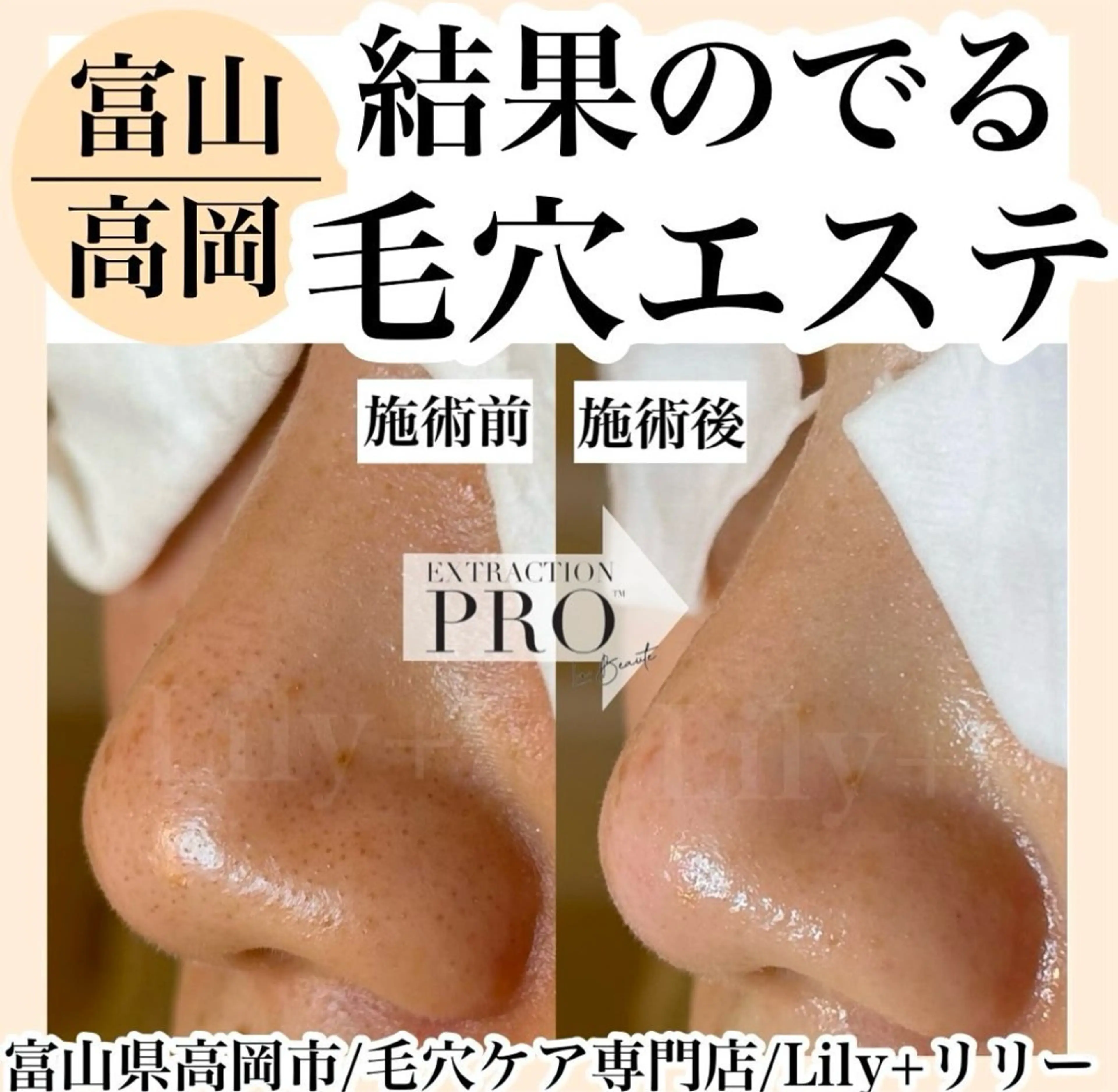 リリー yuriのエステ・リラクイメージ