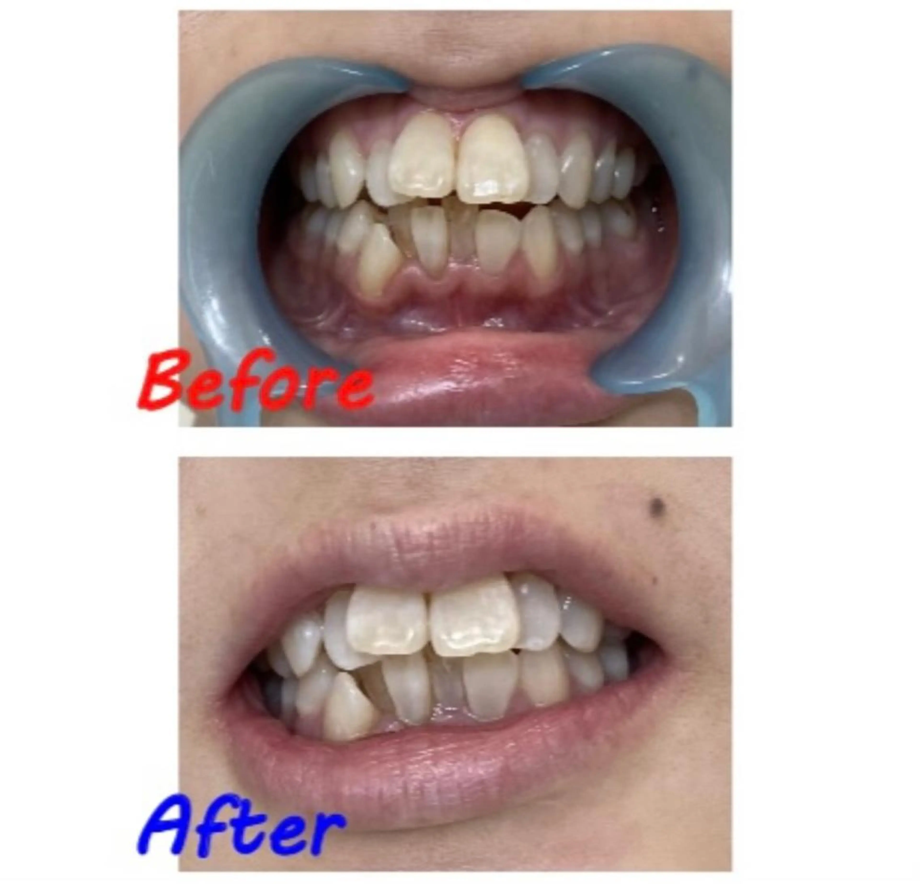 その他 セルフホワイトニングサロン　ラヴィアン所属・ホワイトニングサロン La vie enのその他イメージ