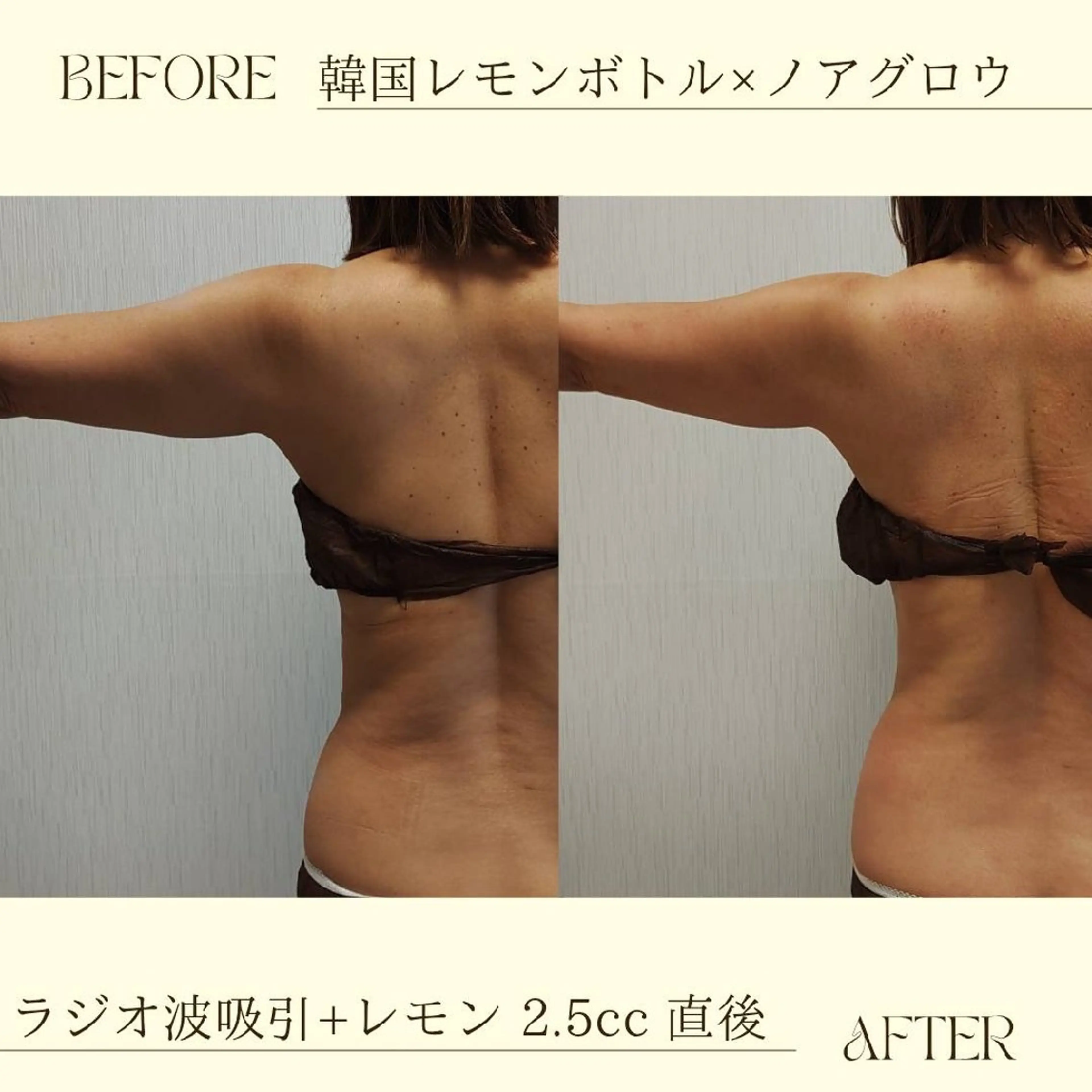 痩身小顔専門 アマテ ビューティー.Nのエステ・リラクイメージ