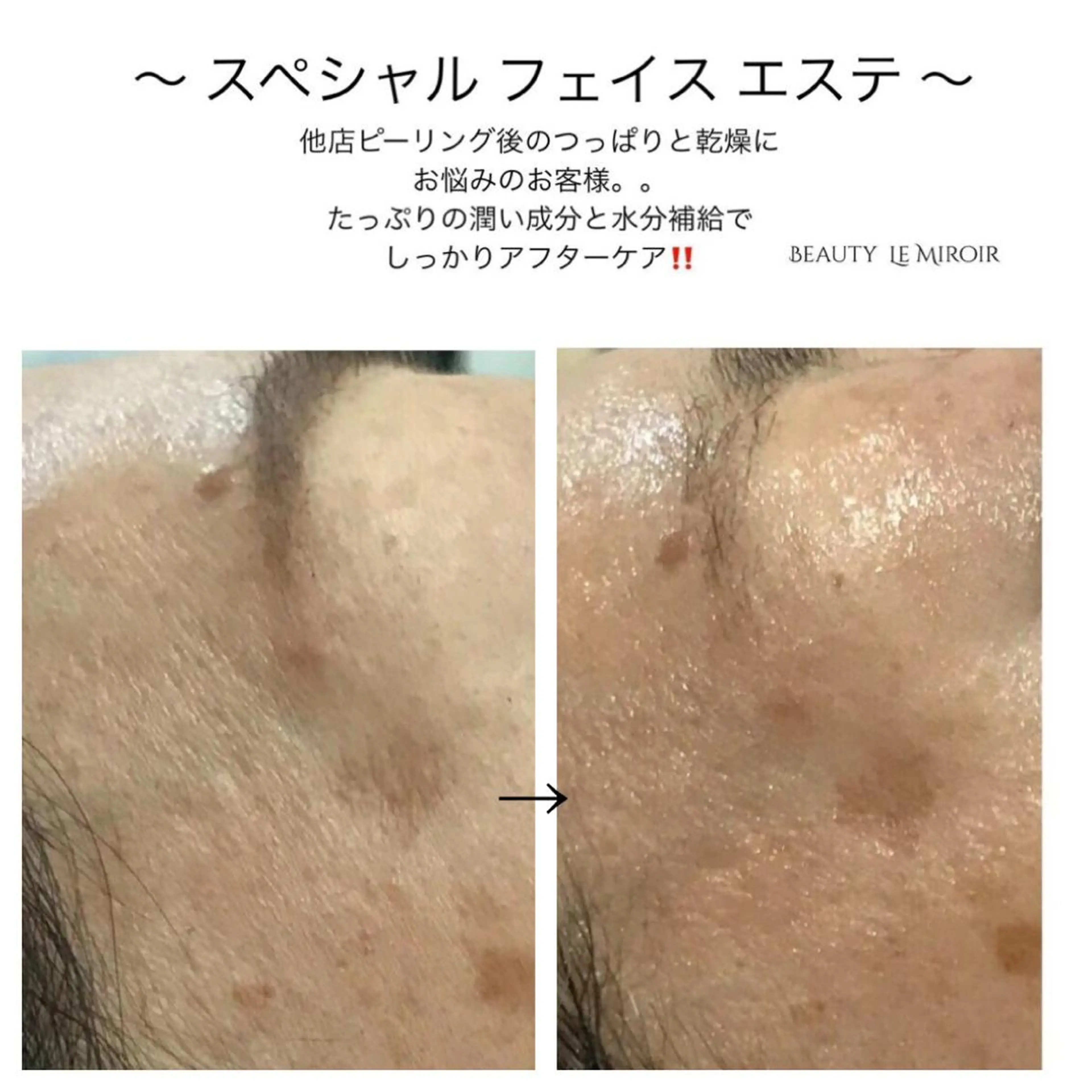 ビューティー ミロワールのエステ・リラクイメージ